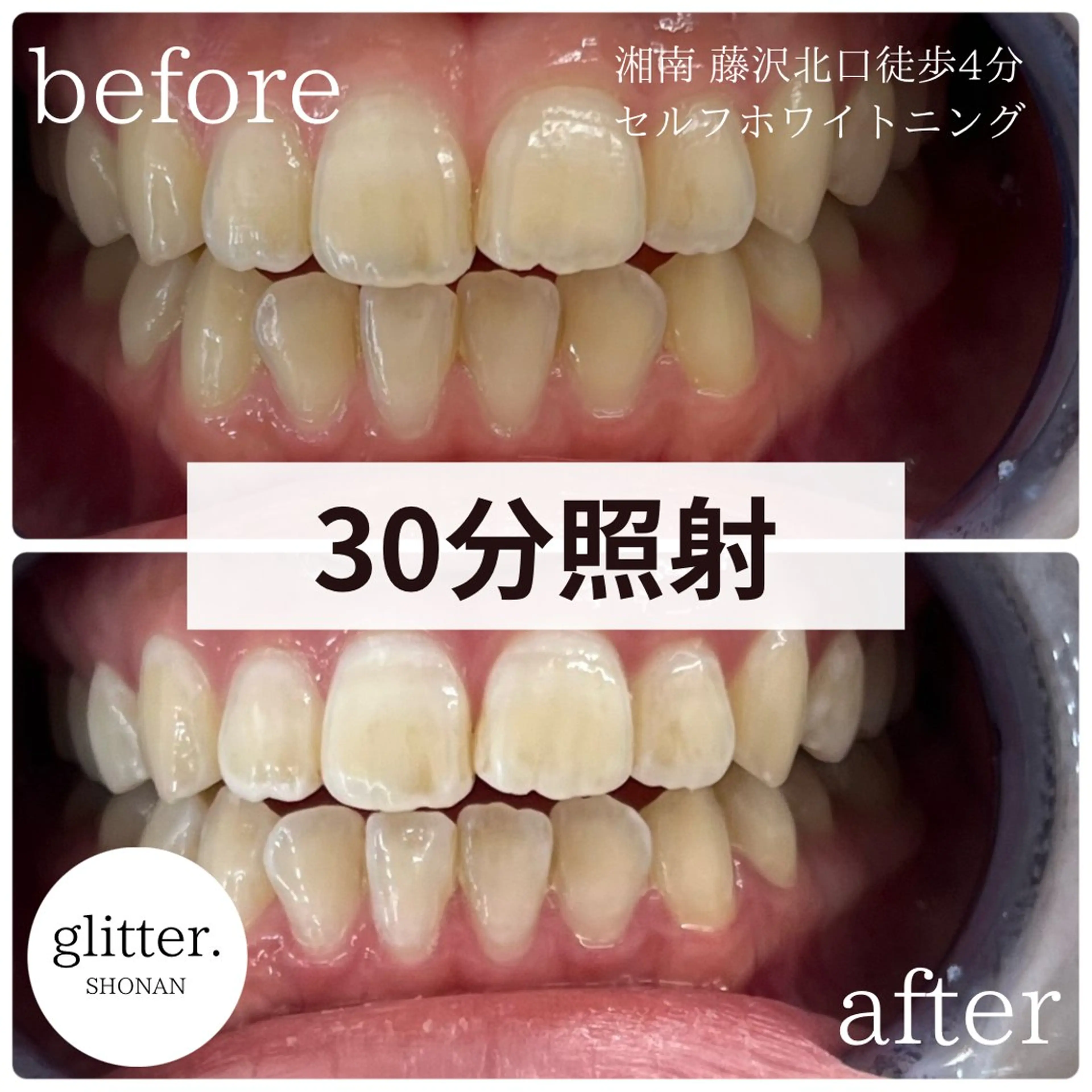 glitter.SHONAN所属・佐久間 茉弥のエステ・リラクイメージ