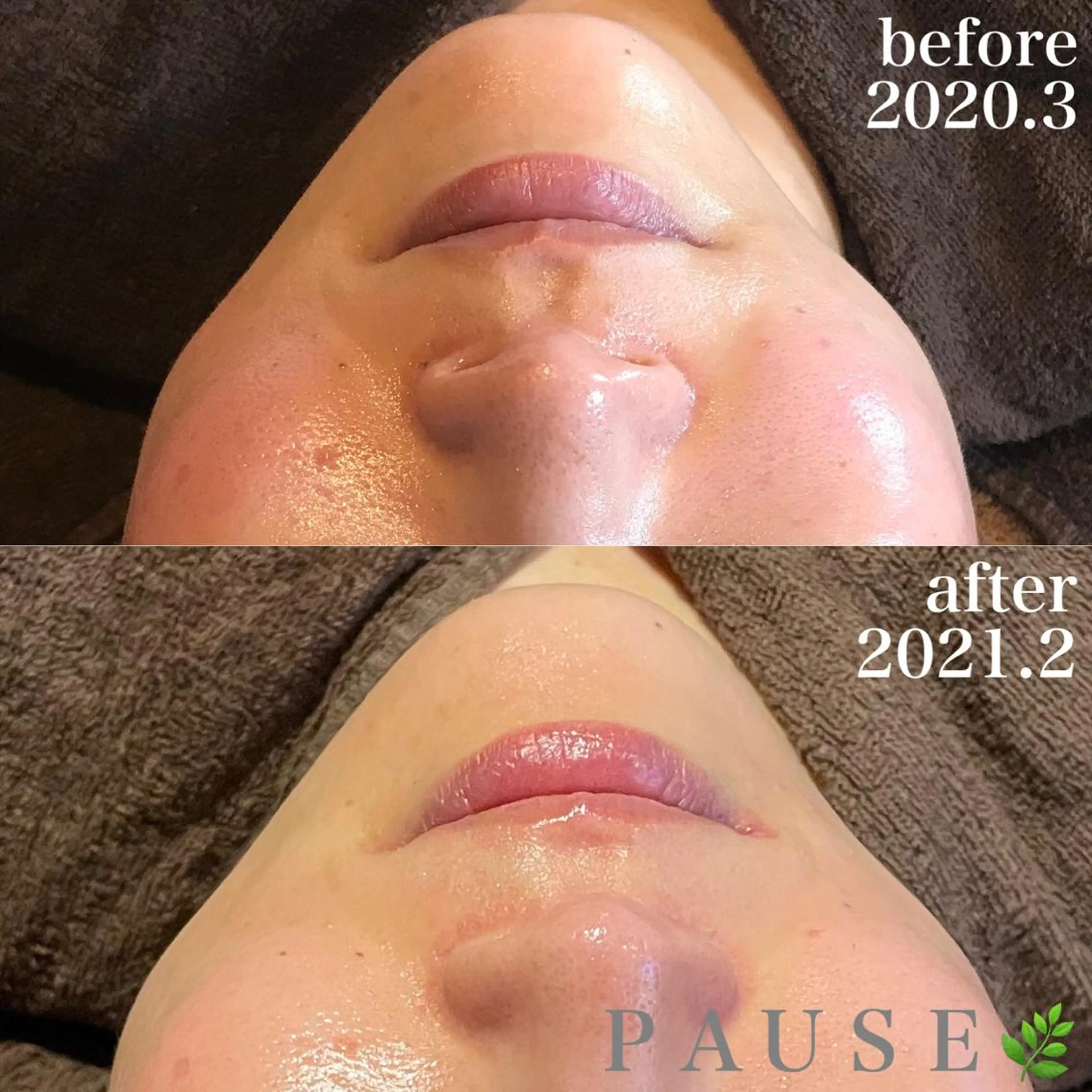 エステ 浜野 恵美のエステ・リラクイメージ