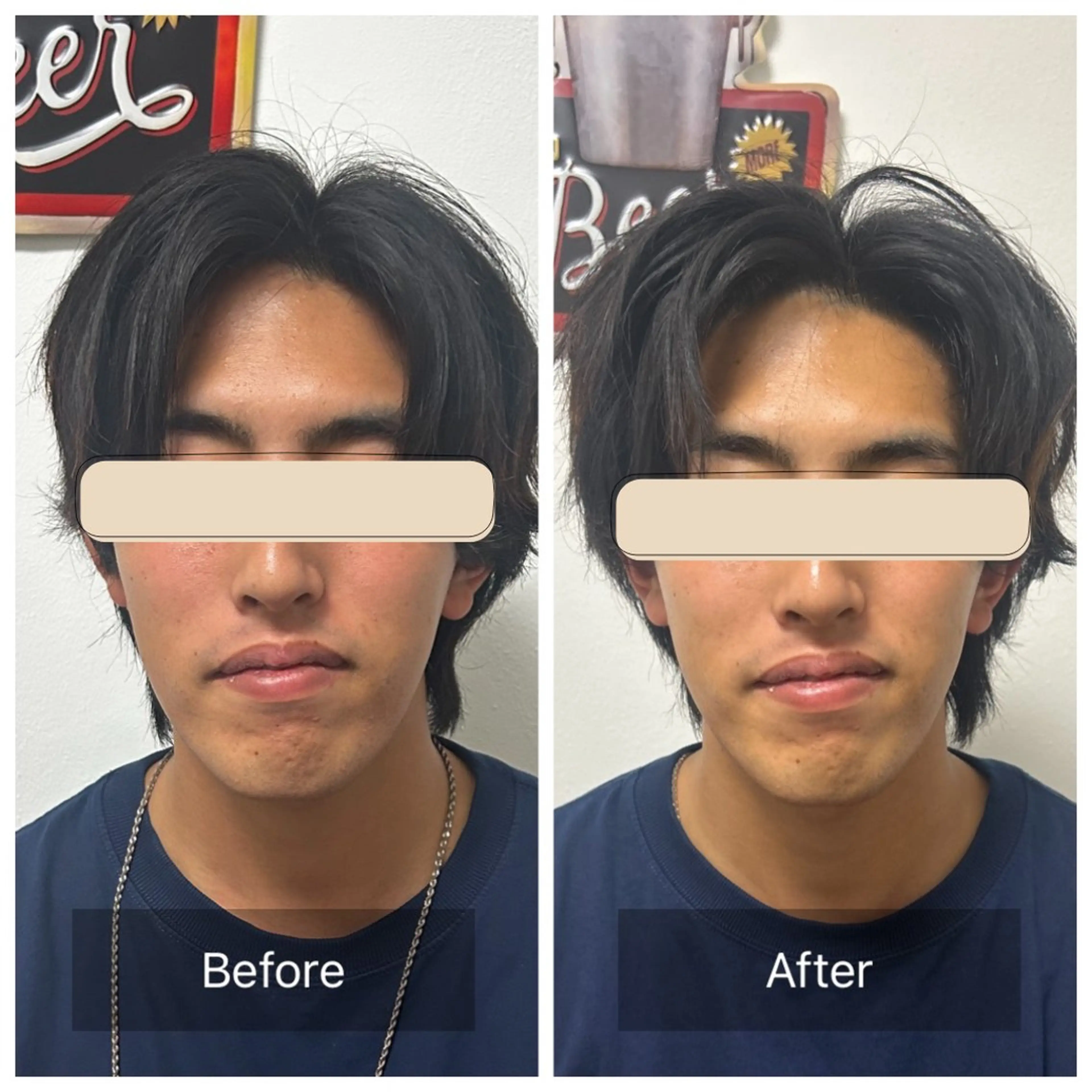 メンズ リラク エマニエル USAのエステ・リラクイメージ