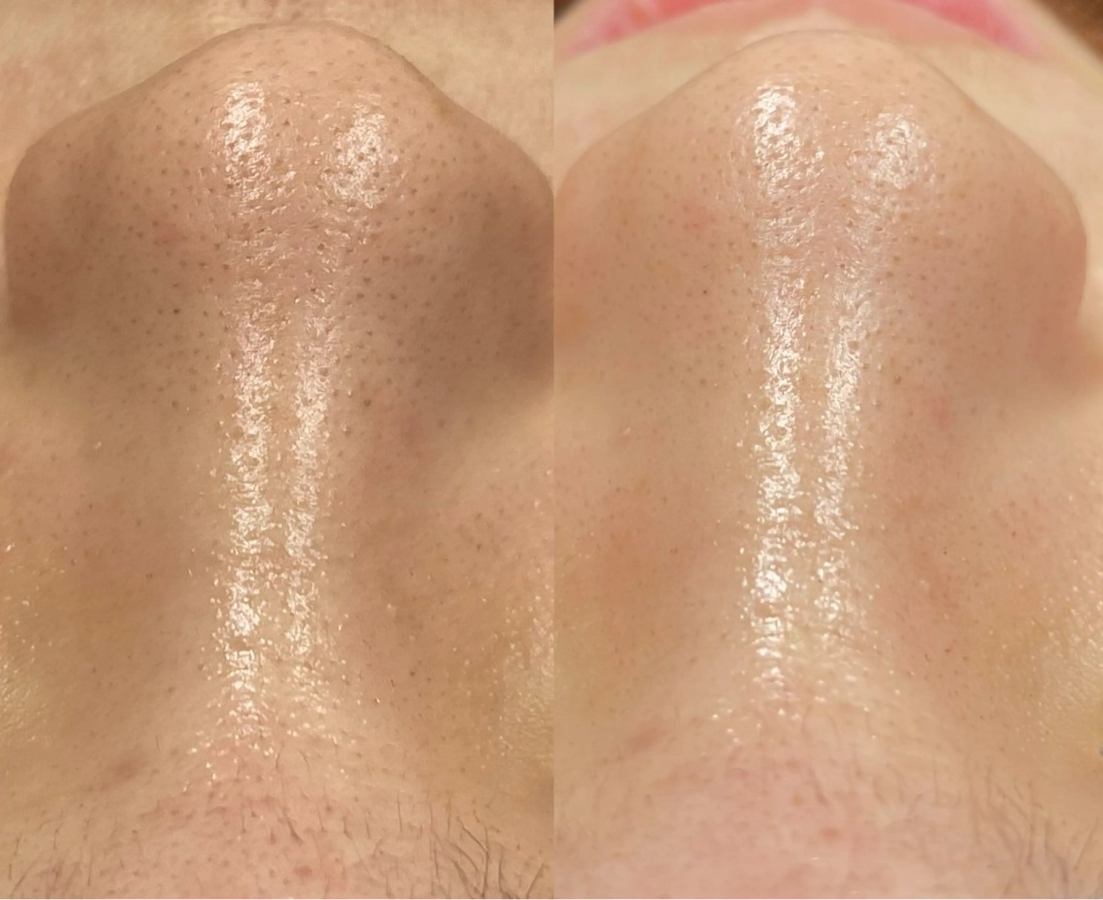 For  Seeds所属・For Seedsのエステ・リラクイメージ