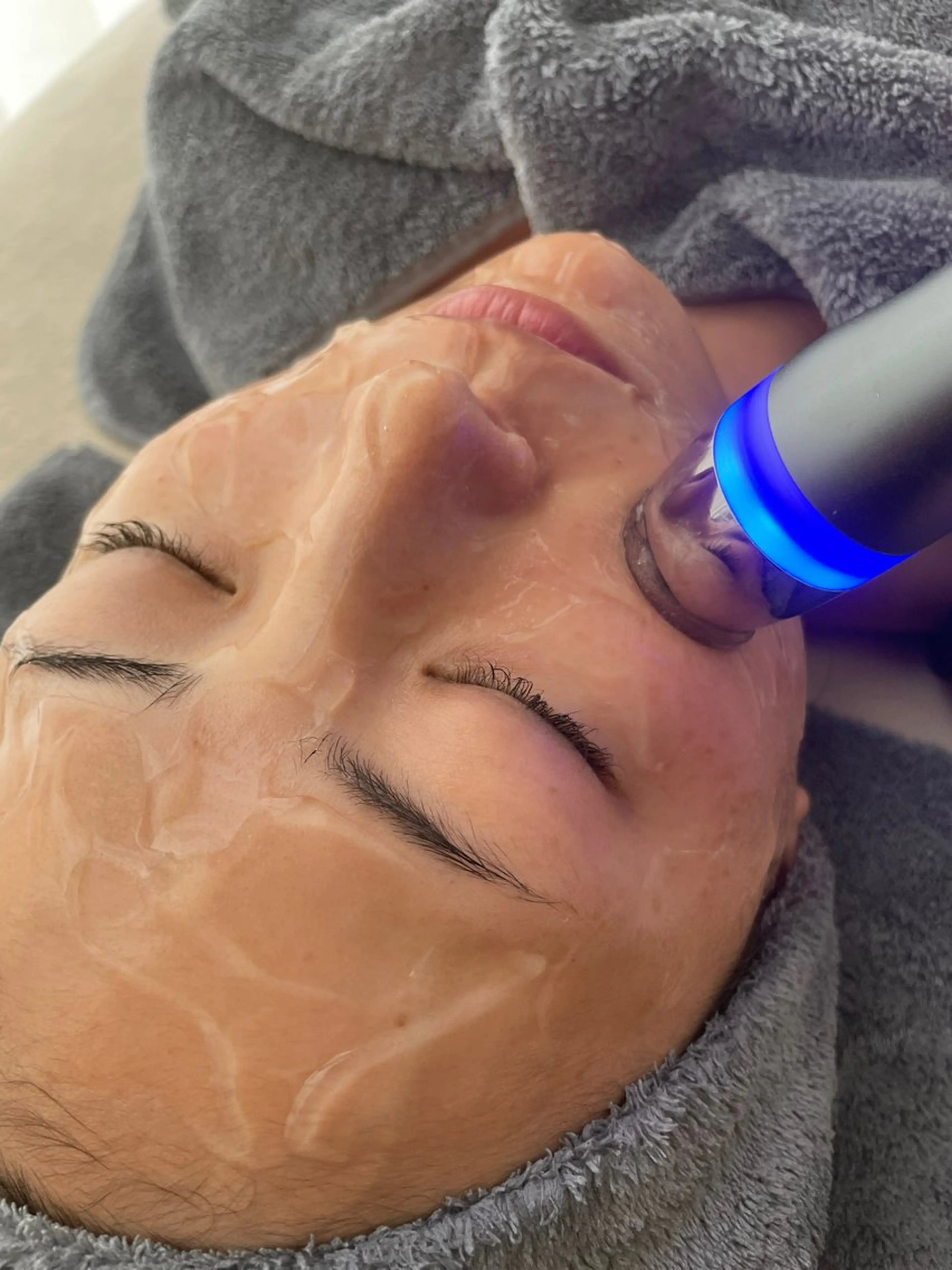 【たるみケア小顔コース】高密度超音波LED水玉リフティング＋保湿パックの写真