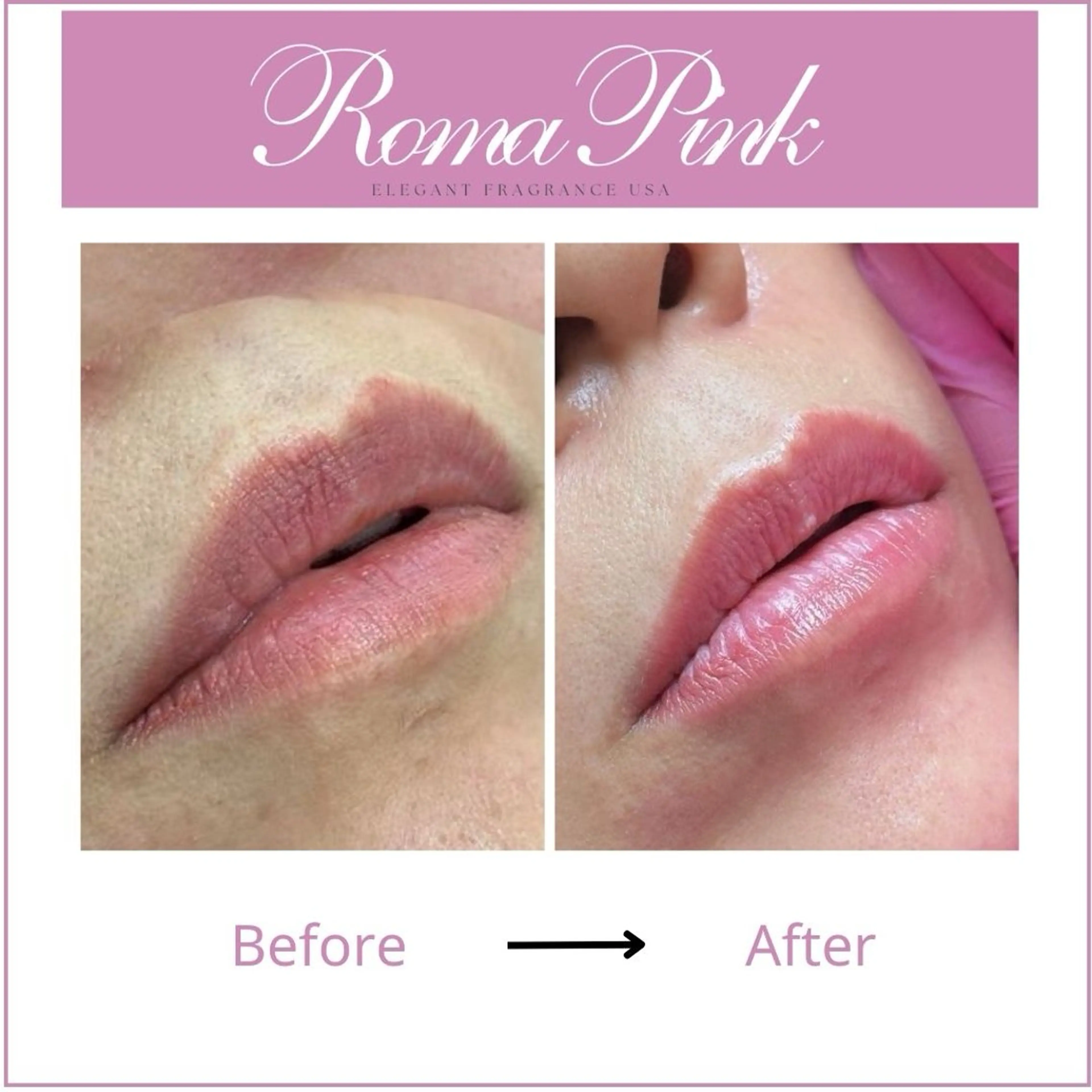 ローマピンク【リップ】モニター特別価格40%OFFの写真