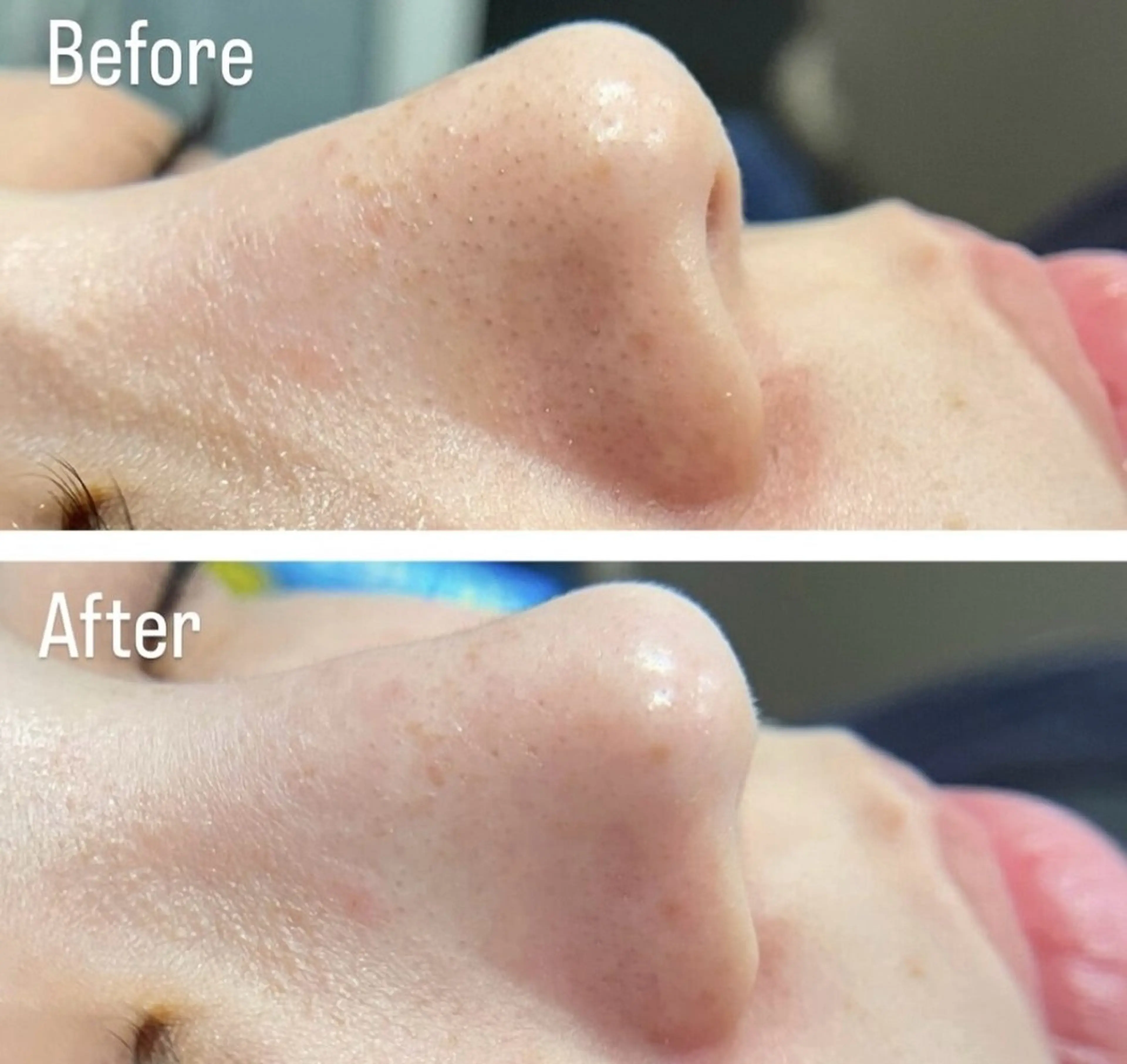 アンド ミルルのエステ・リラクイメージ