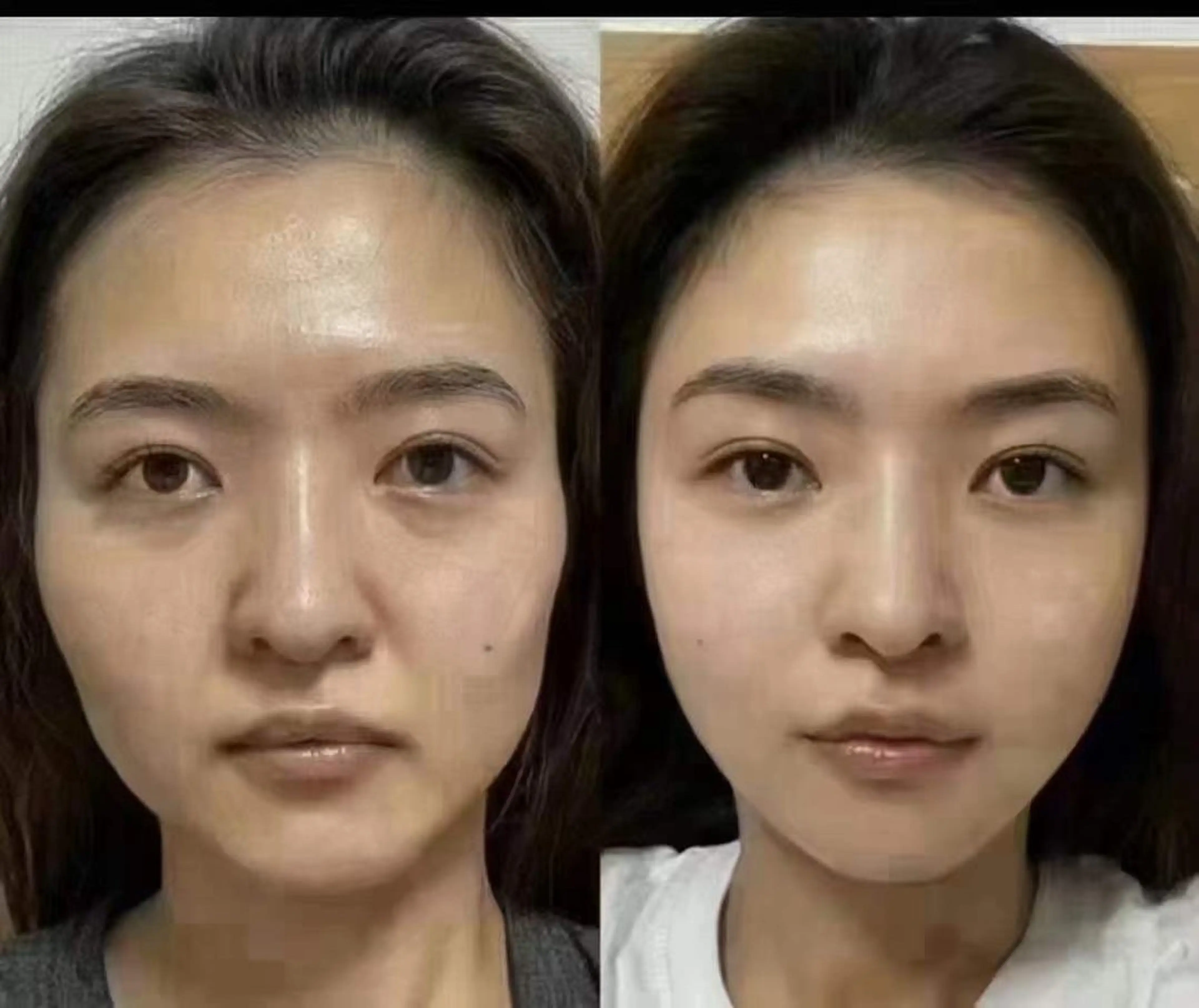 ネイル ブライダルネイル ホワイト エステ aliaハイフ&水光ジェットサロン所属・aliaハーブ水光店 エステティシャン募集のエステ・リラクイメージ