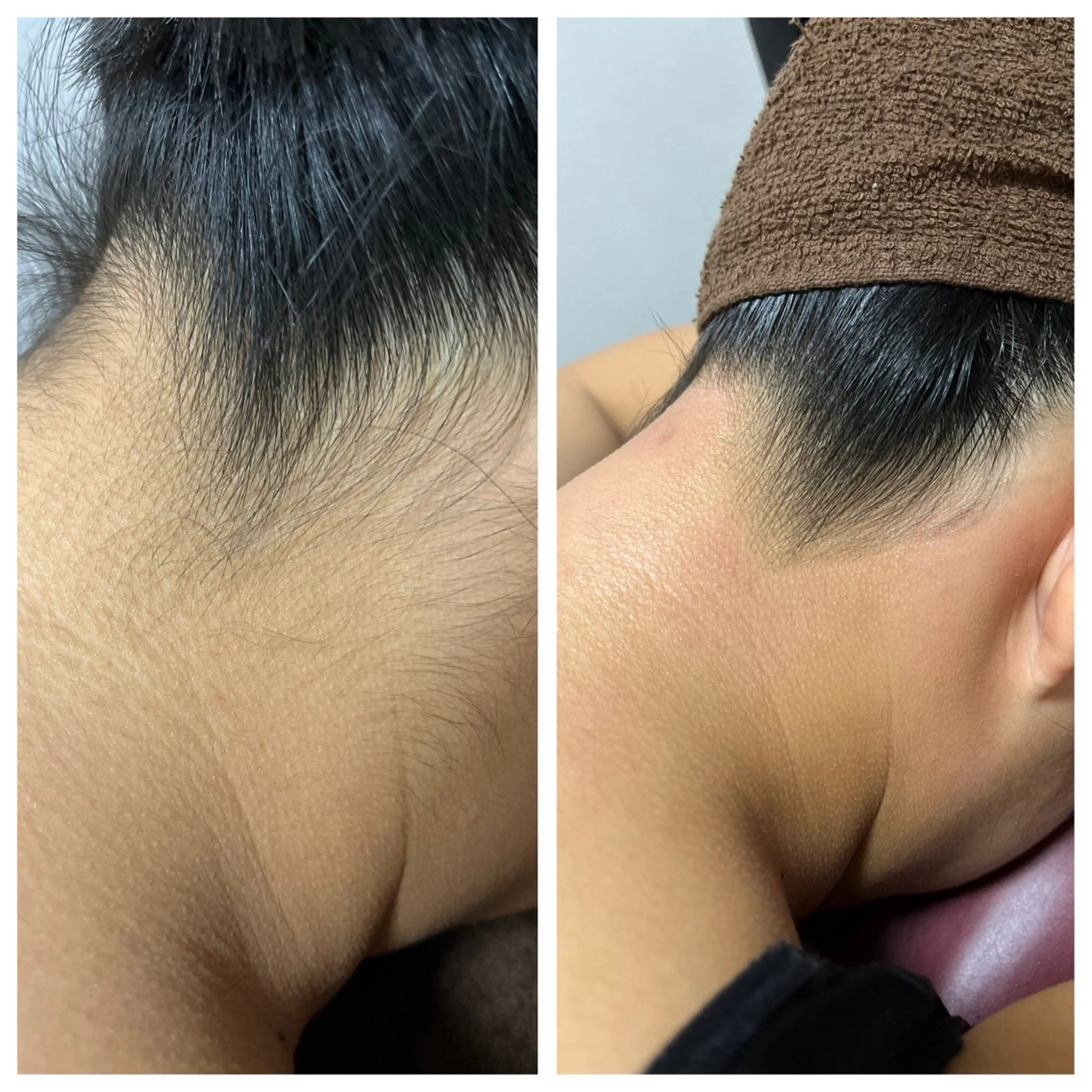 脱毛 salon improve所属・Salon Improveのネイルデザイン