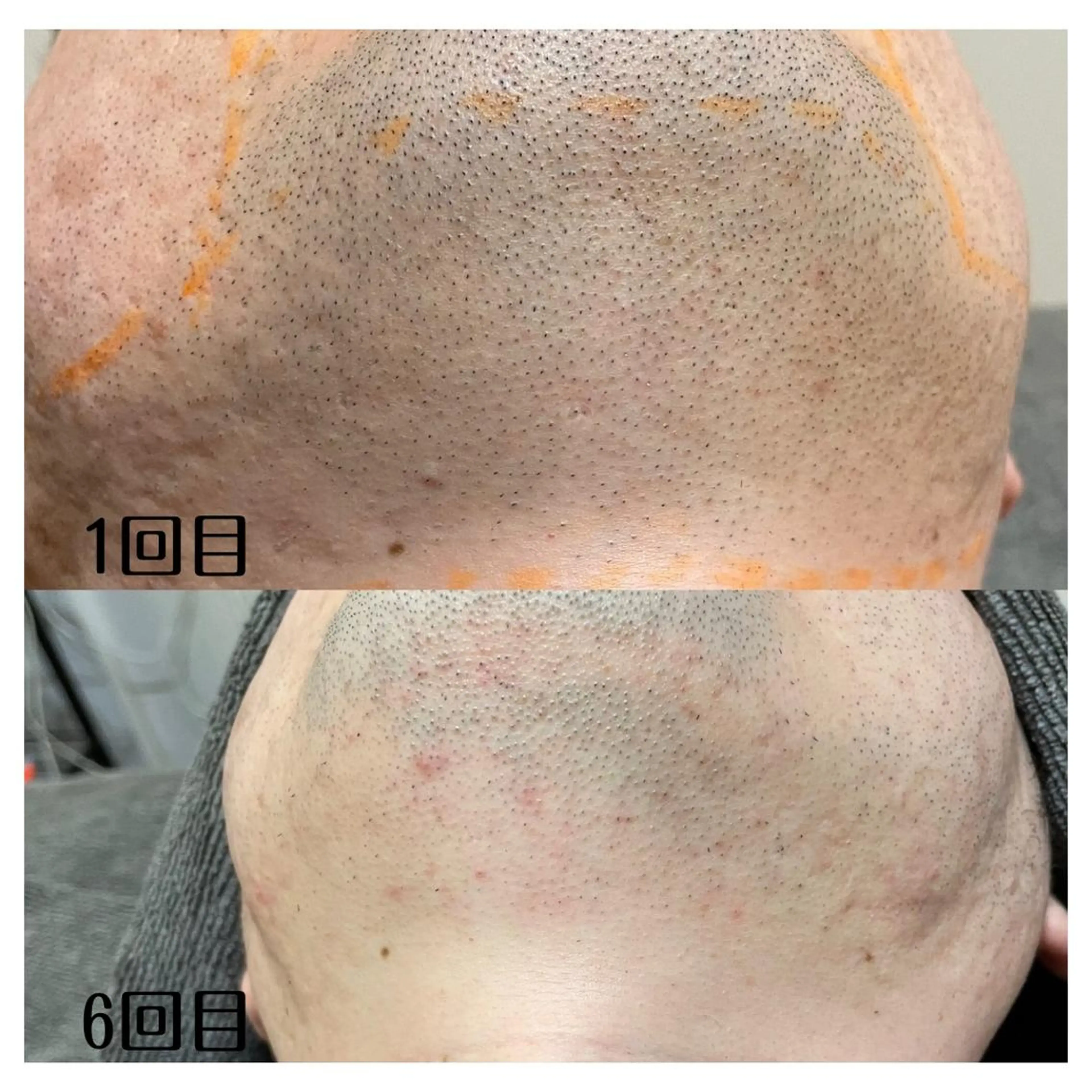 脱毛 DUPE&MORE所属・DUPE&MORE 店長kanaeのエステ・リラクイメージ