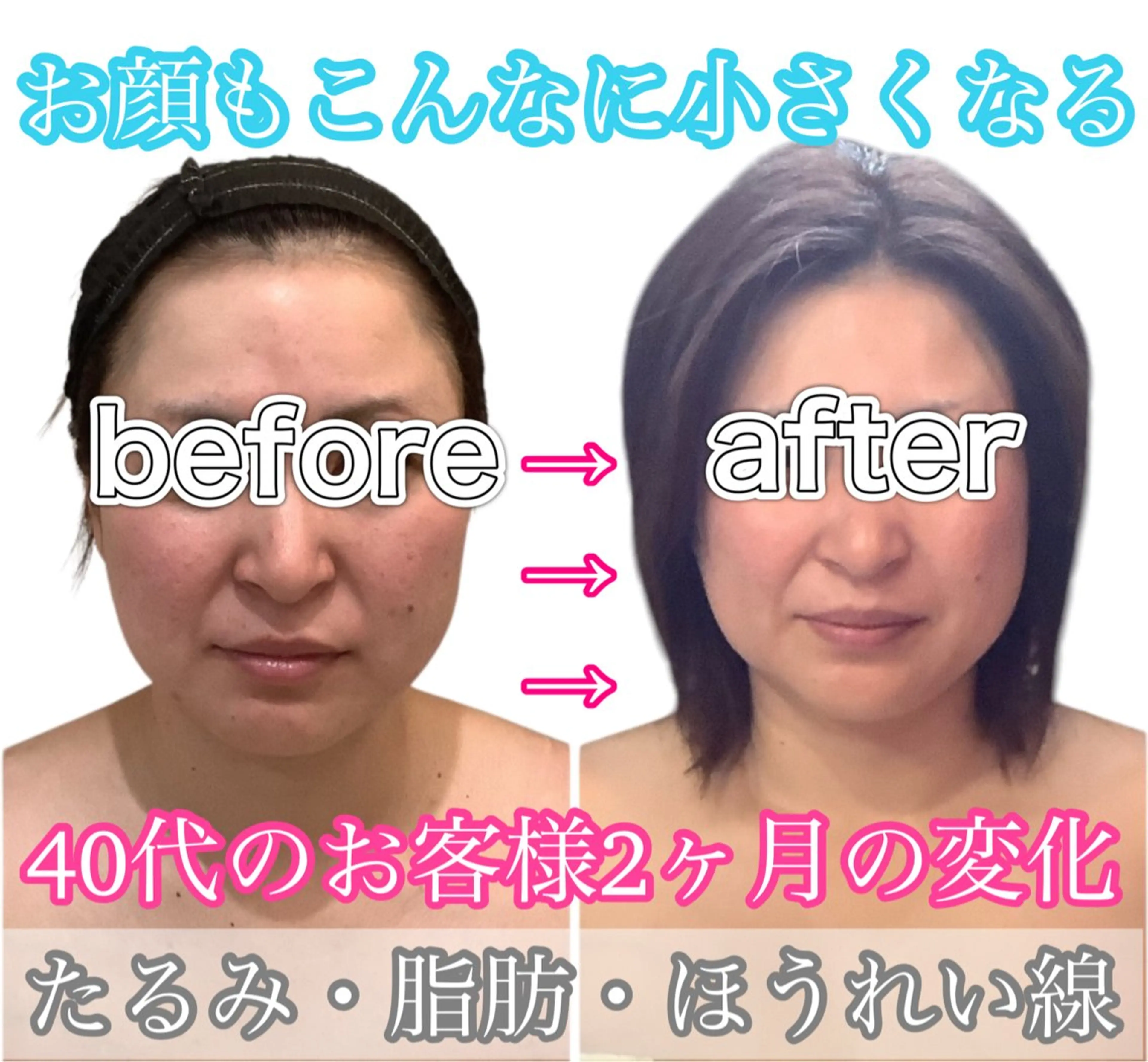 痩身ダイエット&小顔専門店Rs slim(アールズスリム)所属・痩身ダイエット&小顔 🩷アールズスリムのエステ・リラクイメージ