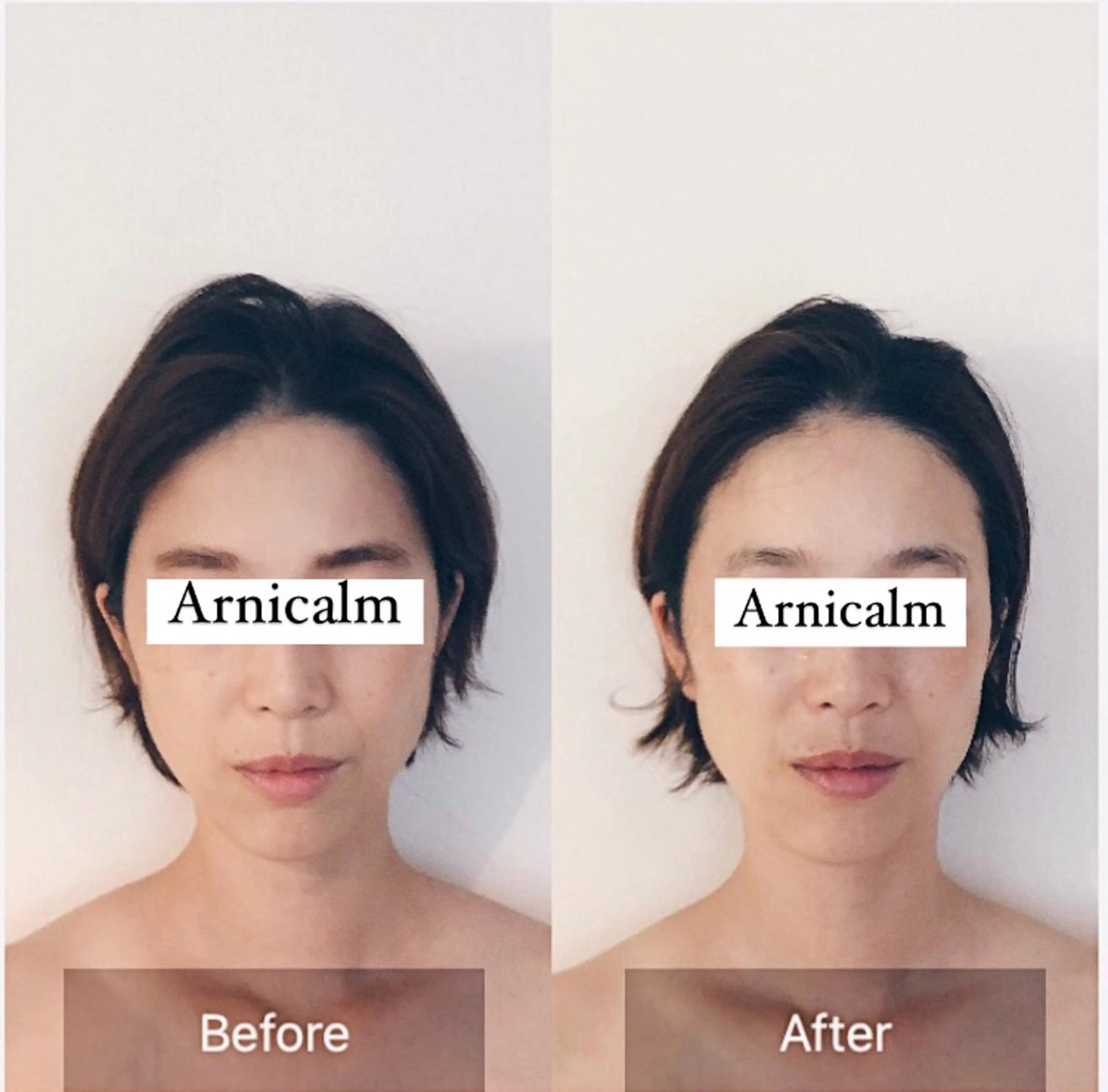 エステ ハーブピーリング 肌再生ピーリング/のエステ・リラクイメージ