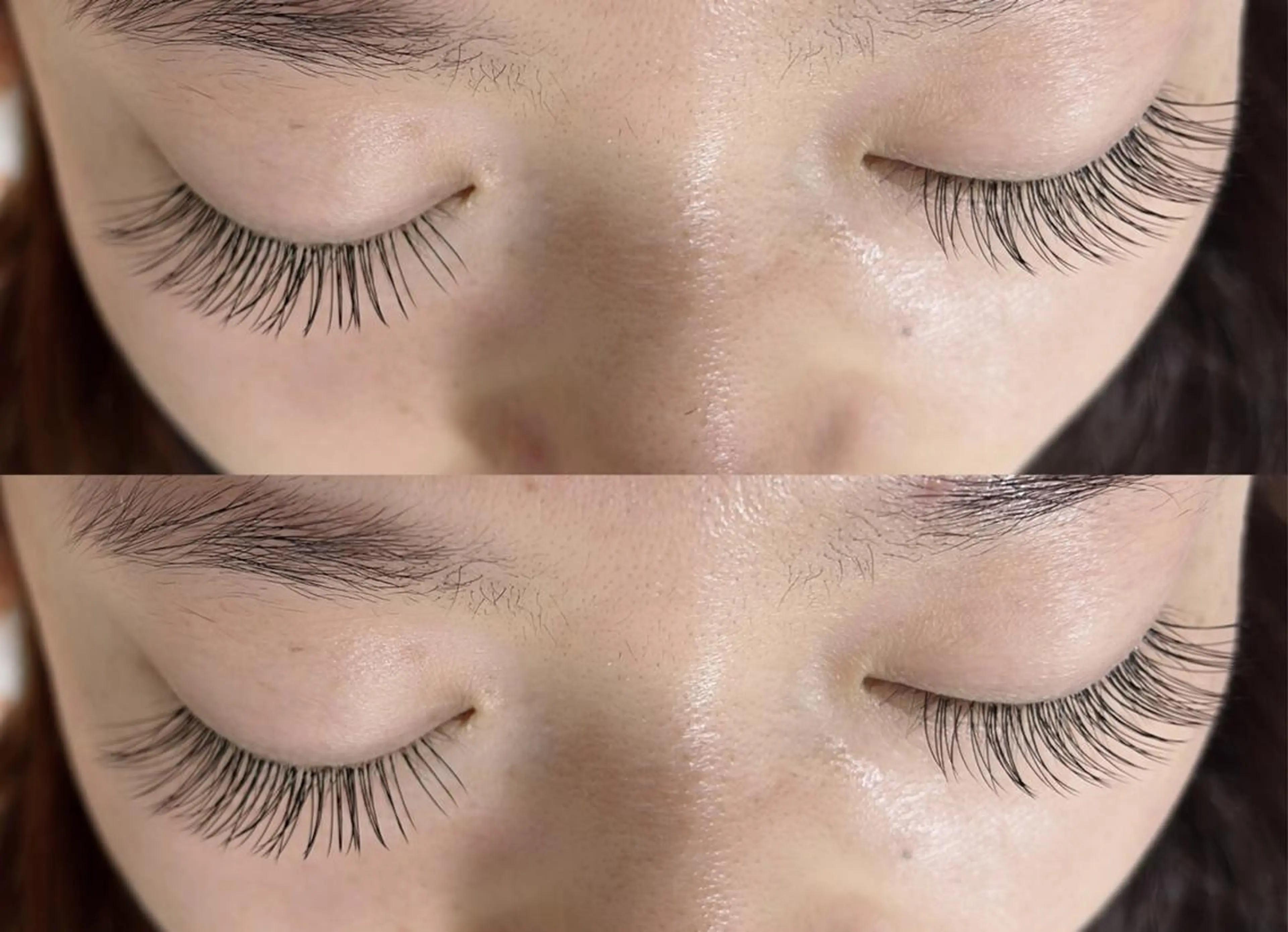 フラットラッシュ100本の写真