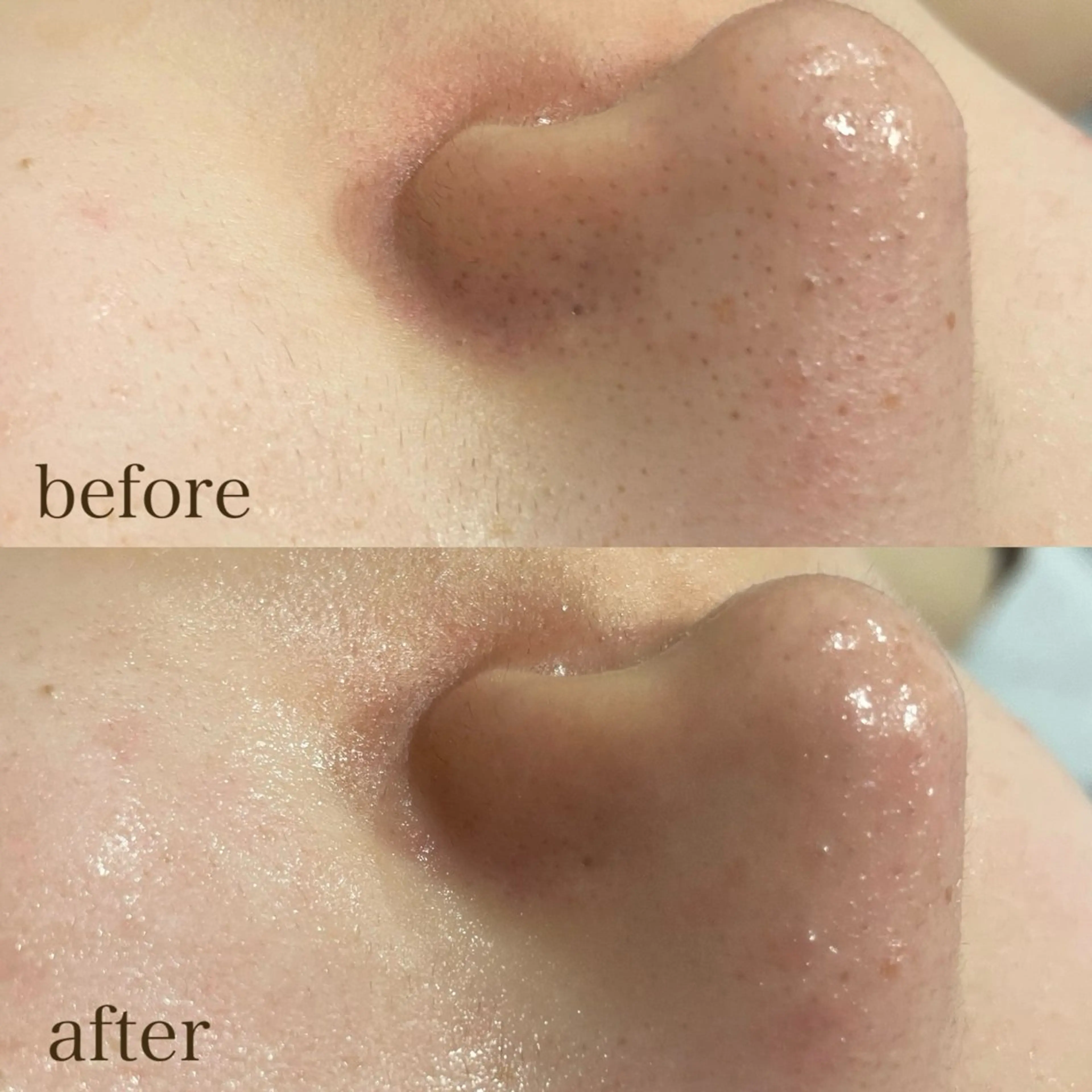 エステ DahliaBeauty ダリアビューティー所属・DahliaBeau tyフェイシャル中村のエステ・リラクイメージ