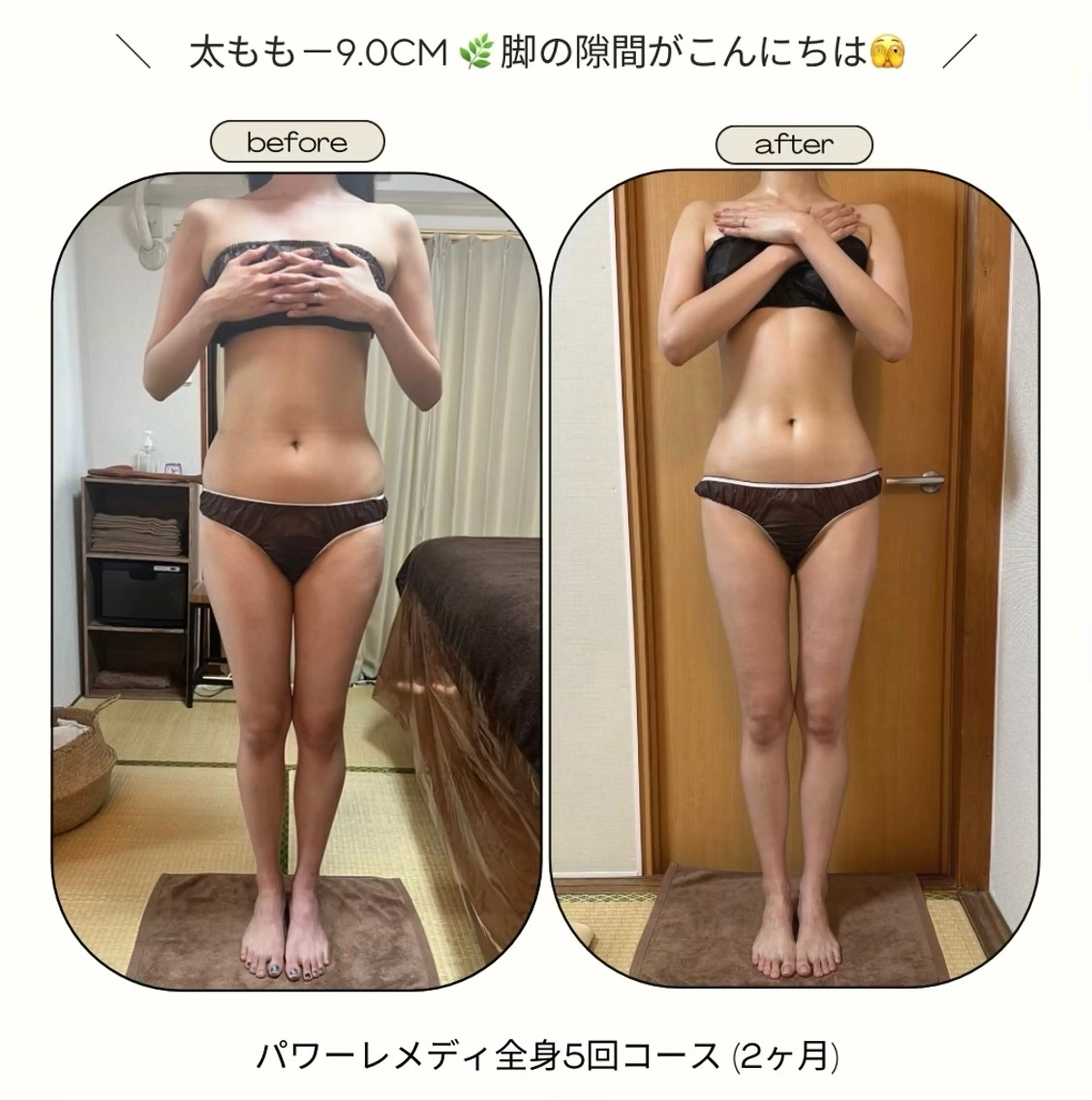 biloop所属・《本気痩せ×疲労改善 》  BILOOPのエステ・リラクイメージ