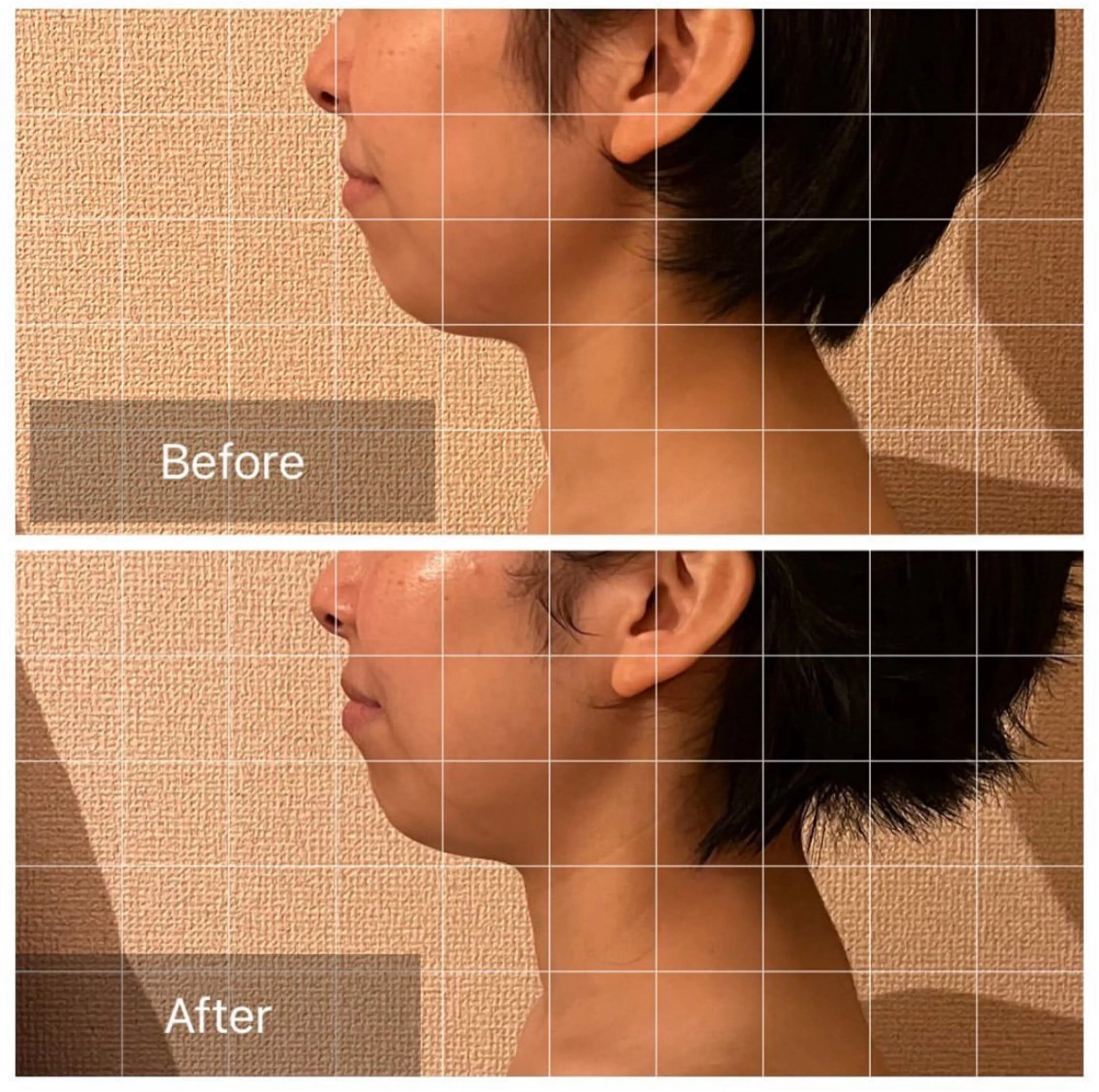 エステ リラク 表情筋フェイシャル 三軒茶屋のエステ・リラクイメージ