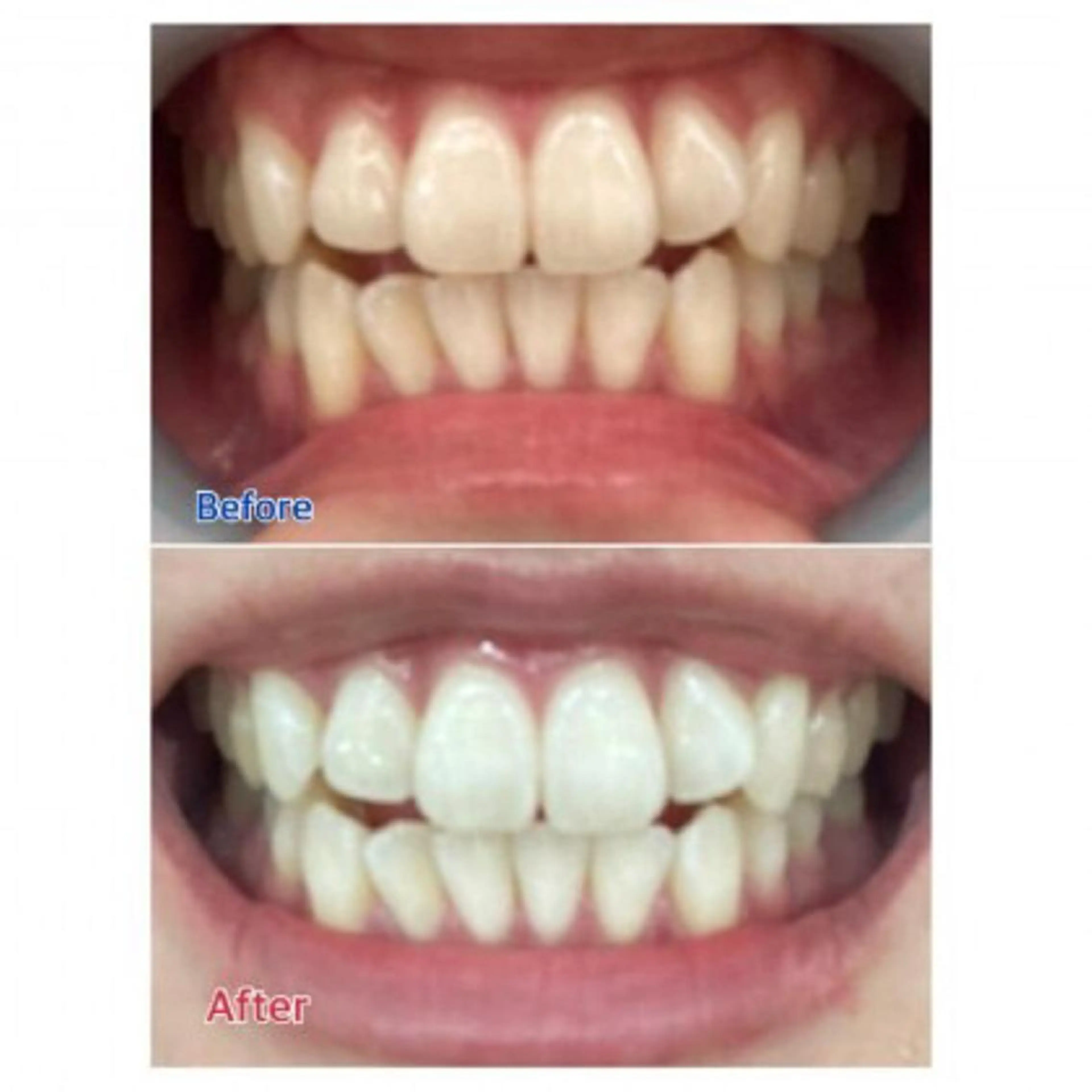 M渋谷店所属・Ｍ渋谷 ホワイトニングのエステ・リラクイメージ