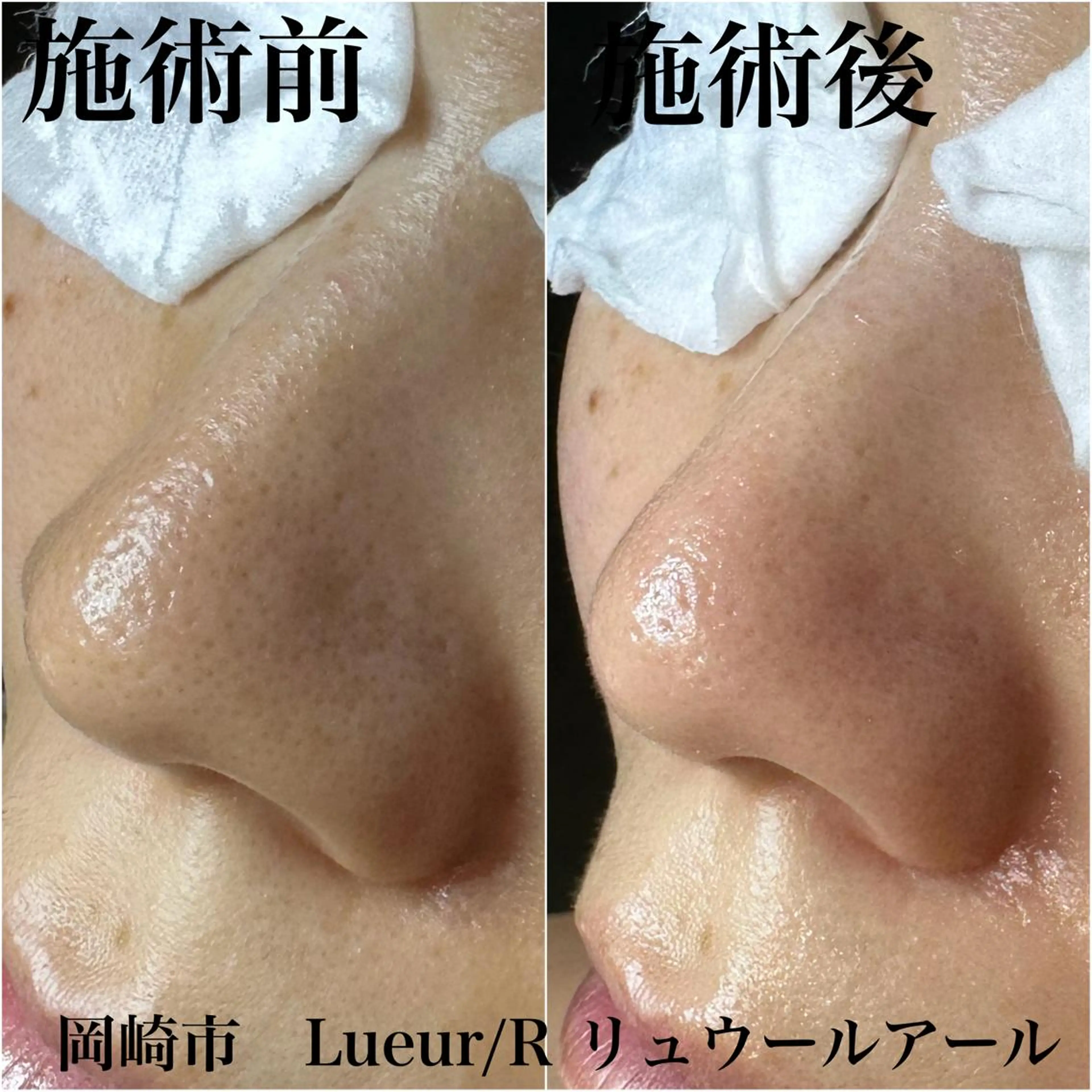 エステ 大久保 里奈のエステ・リラクイメージ