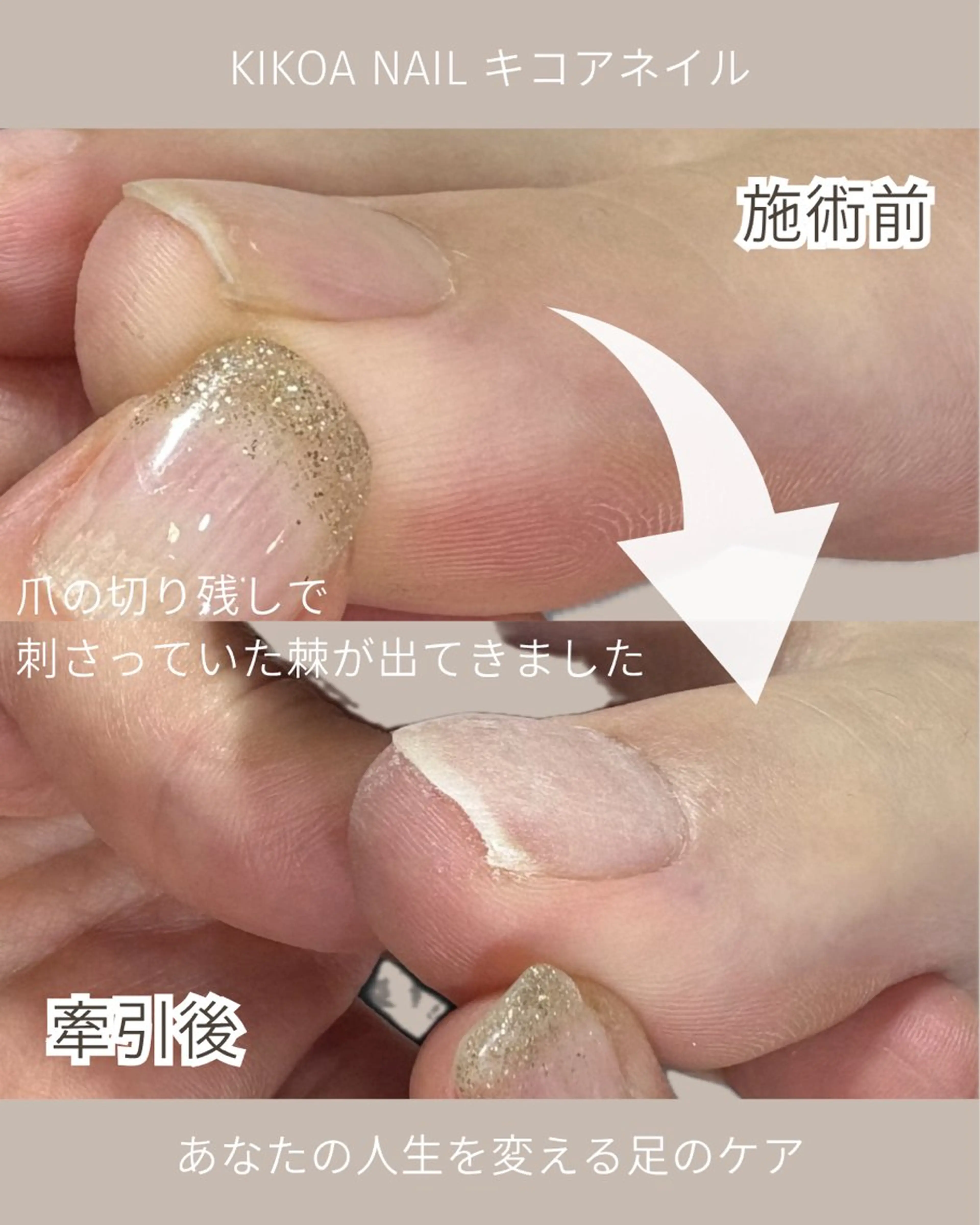 ネイル KIKOA NAIL キコアネイルのネイルデザイン