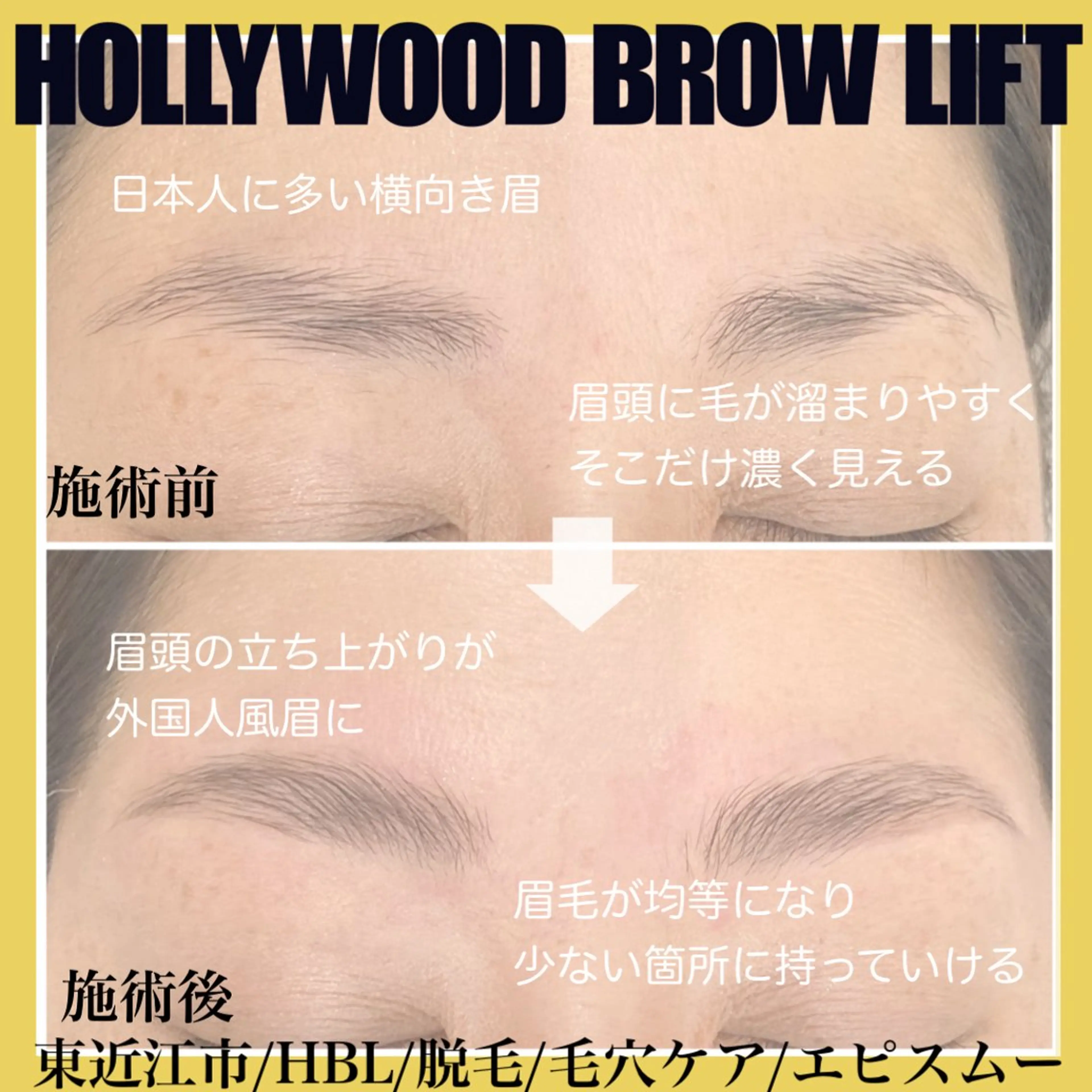 アイブロウ その他(アイブロウ) epismoo 脱毛/HBL/毛穴の眉毛・アイブロウイメージ