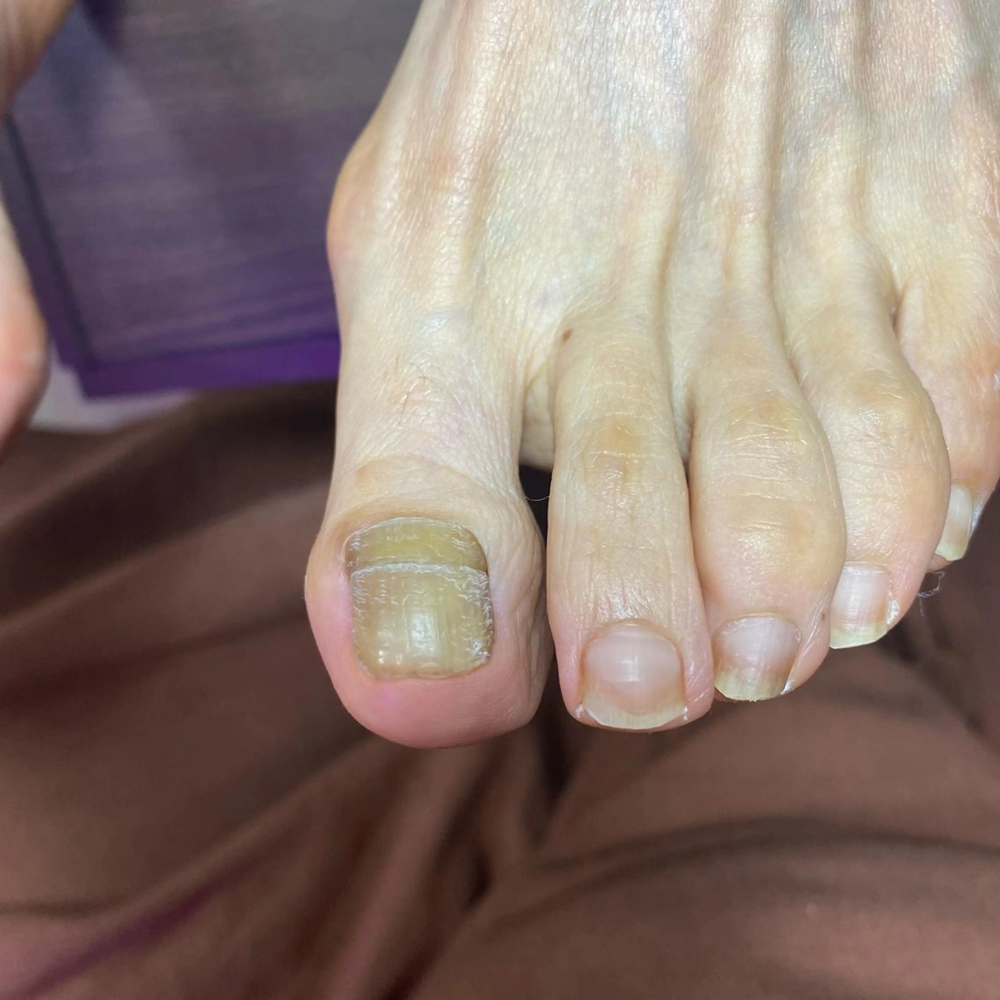 ネイル preciosa.nail所属・久場 晴美のネイルデザイン