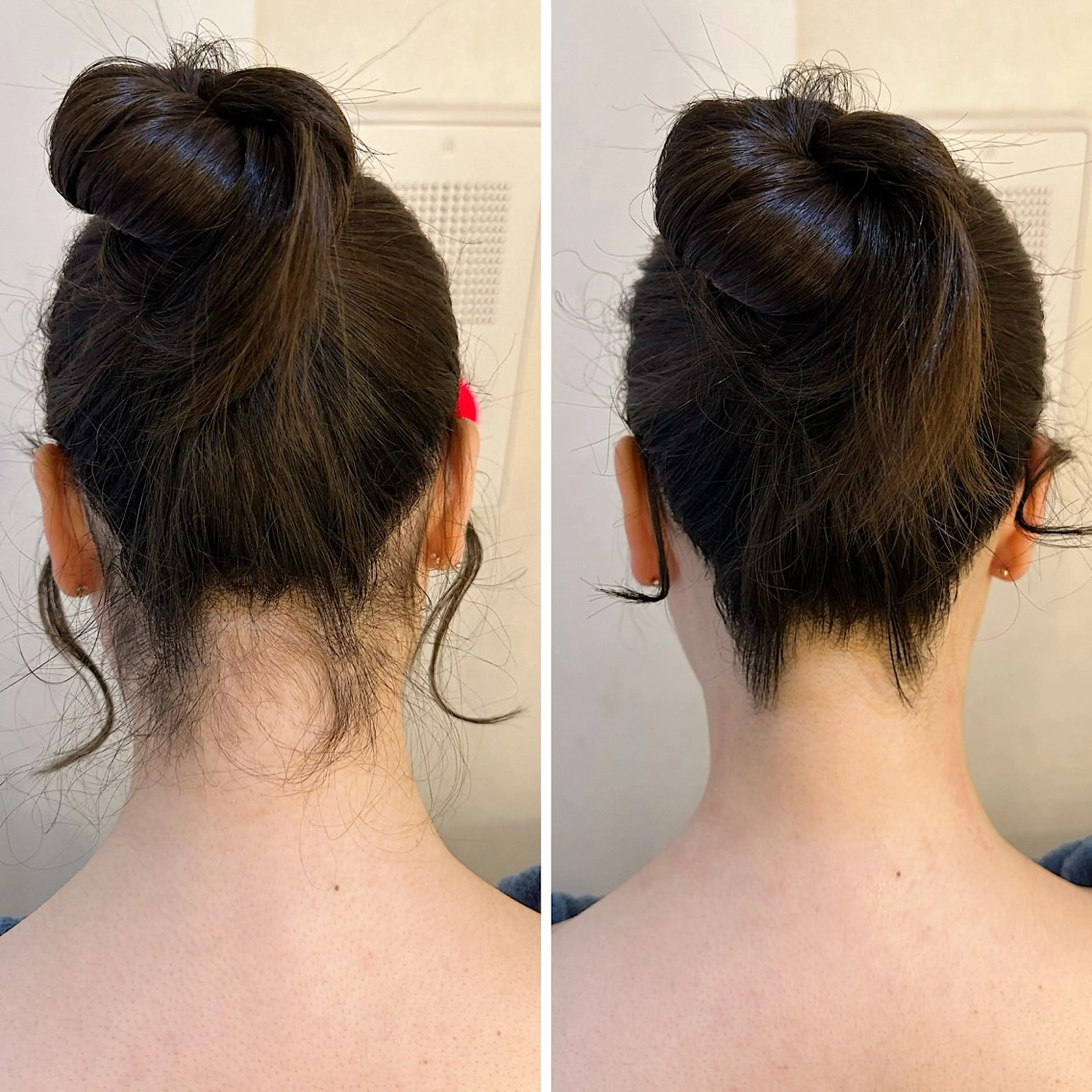 脱毛 うなじ脱毛/美肌脱毛 LABELのエステ・リラクイメージ