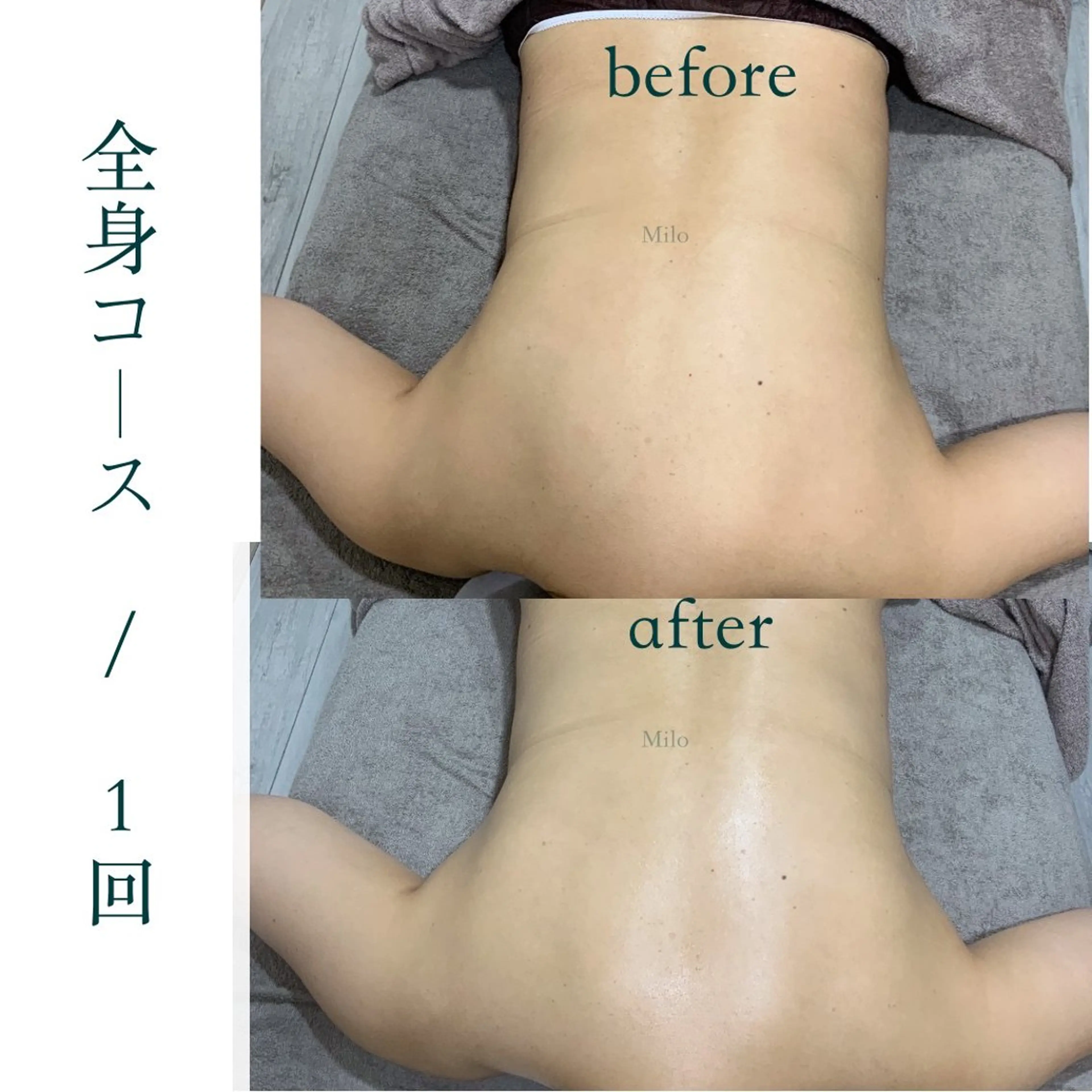 当日限定【小顔矯正＋ヘッドスパ+全身矯正✨】オールハンド&オイルリンパのカスタム施術🙌肩こり&快眠アプローチ☆90分の写真