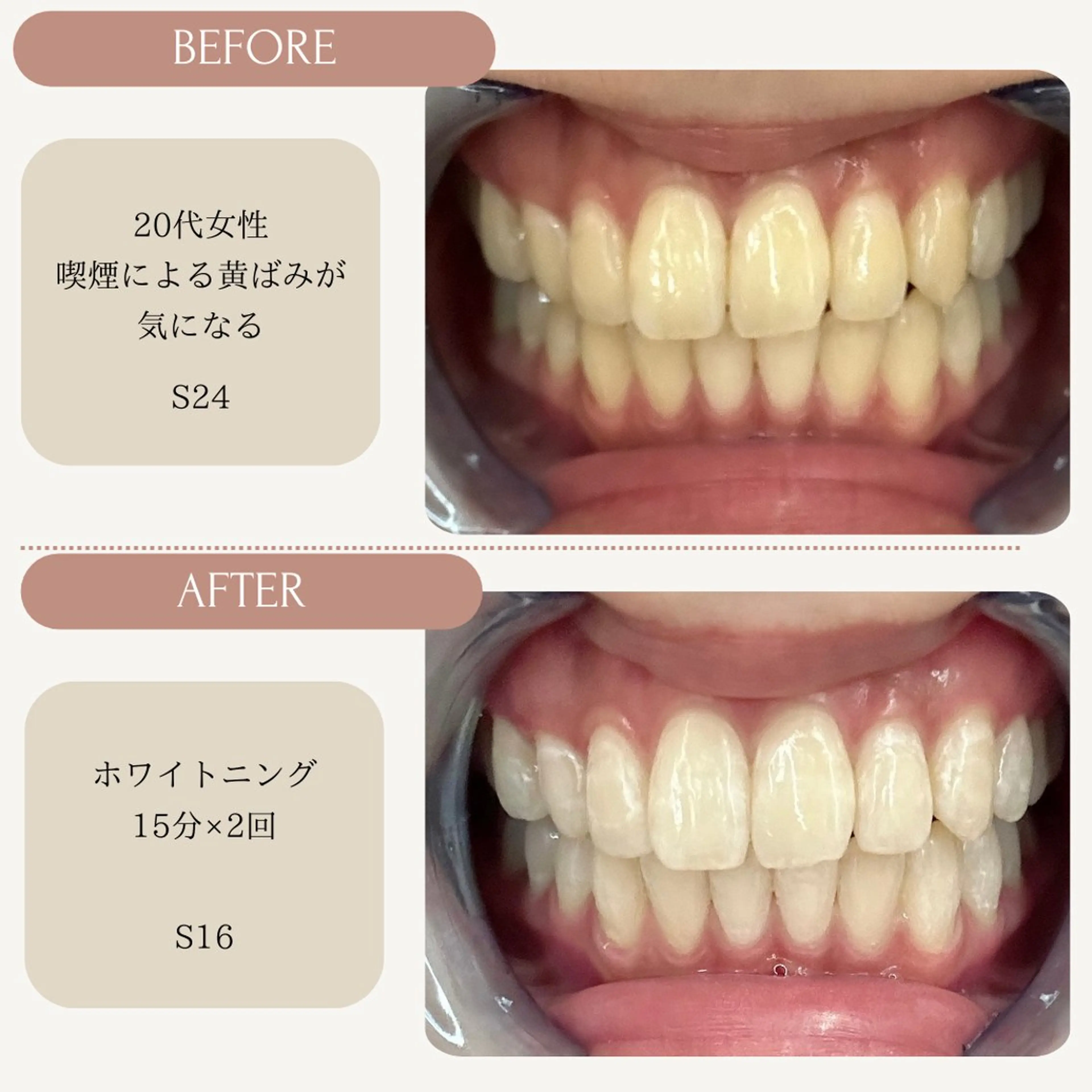 Whitening Carat 恵比寿店所属・ホワイトニング カラット 恵比寿店のエステ・リラクイメージ