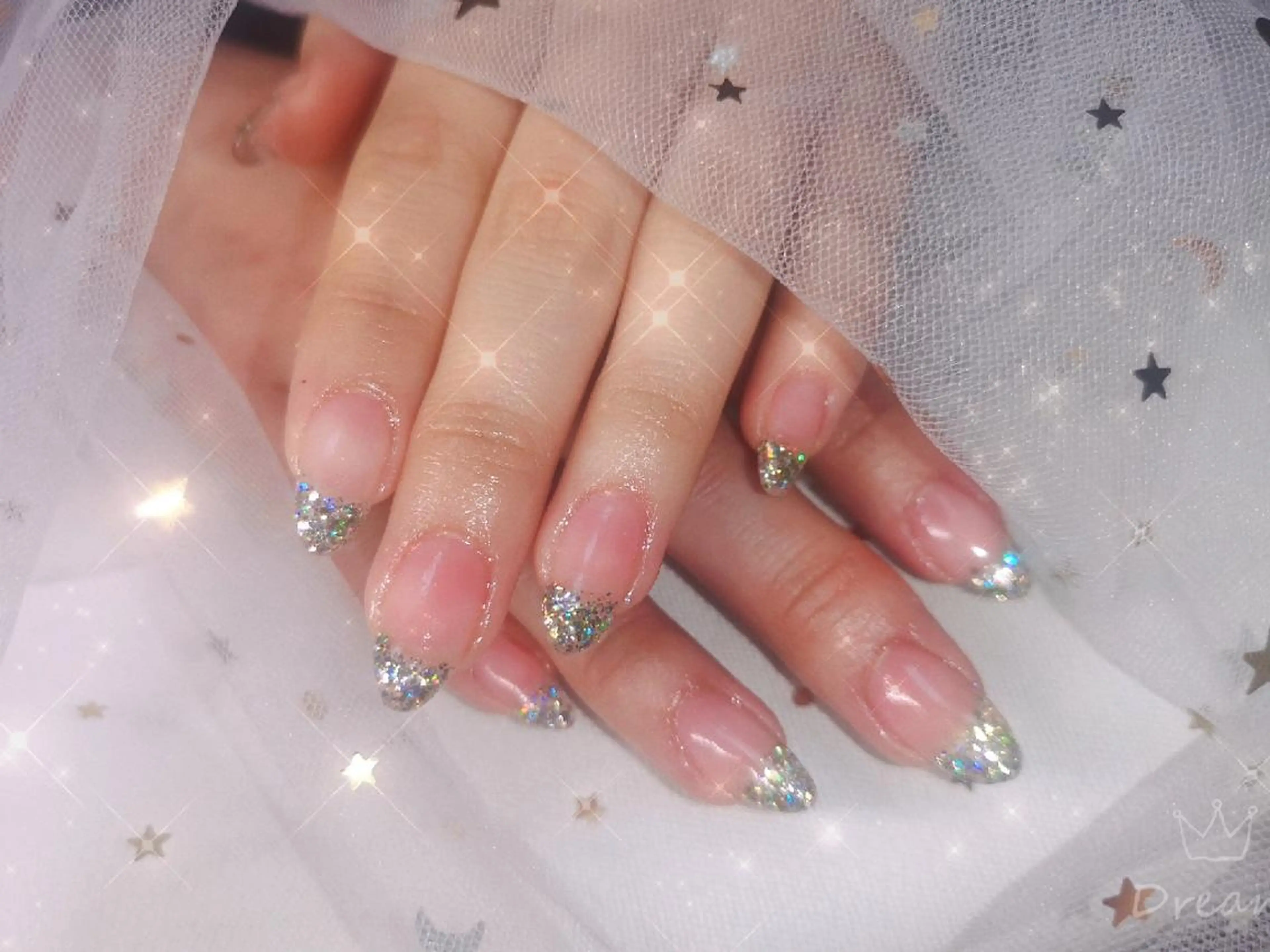 ミディアム ネイル ネイリストゆか💅 長さだし、深爪矯正のネイルデザイン