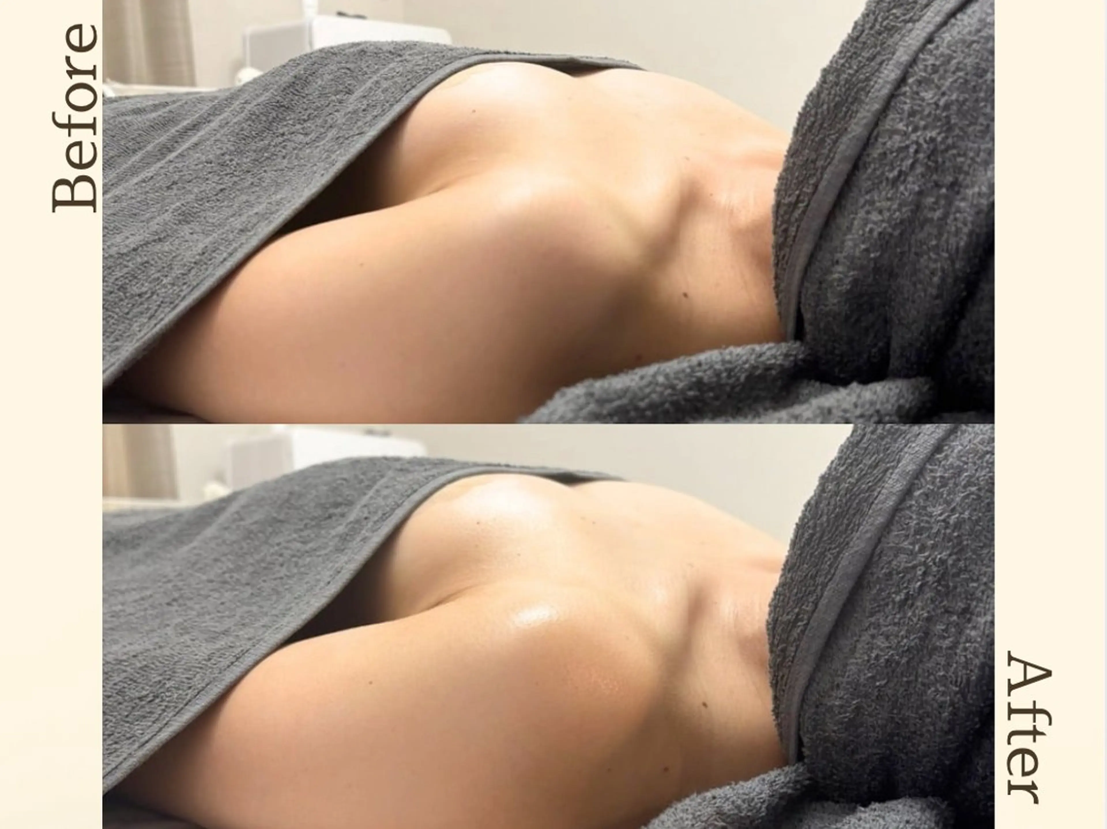 エステ リラク バストケア専門店| canyのエステ・リラクイメージ