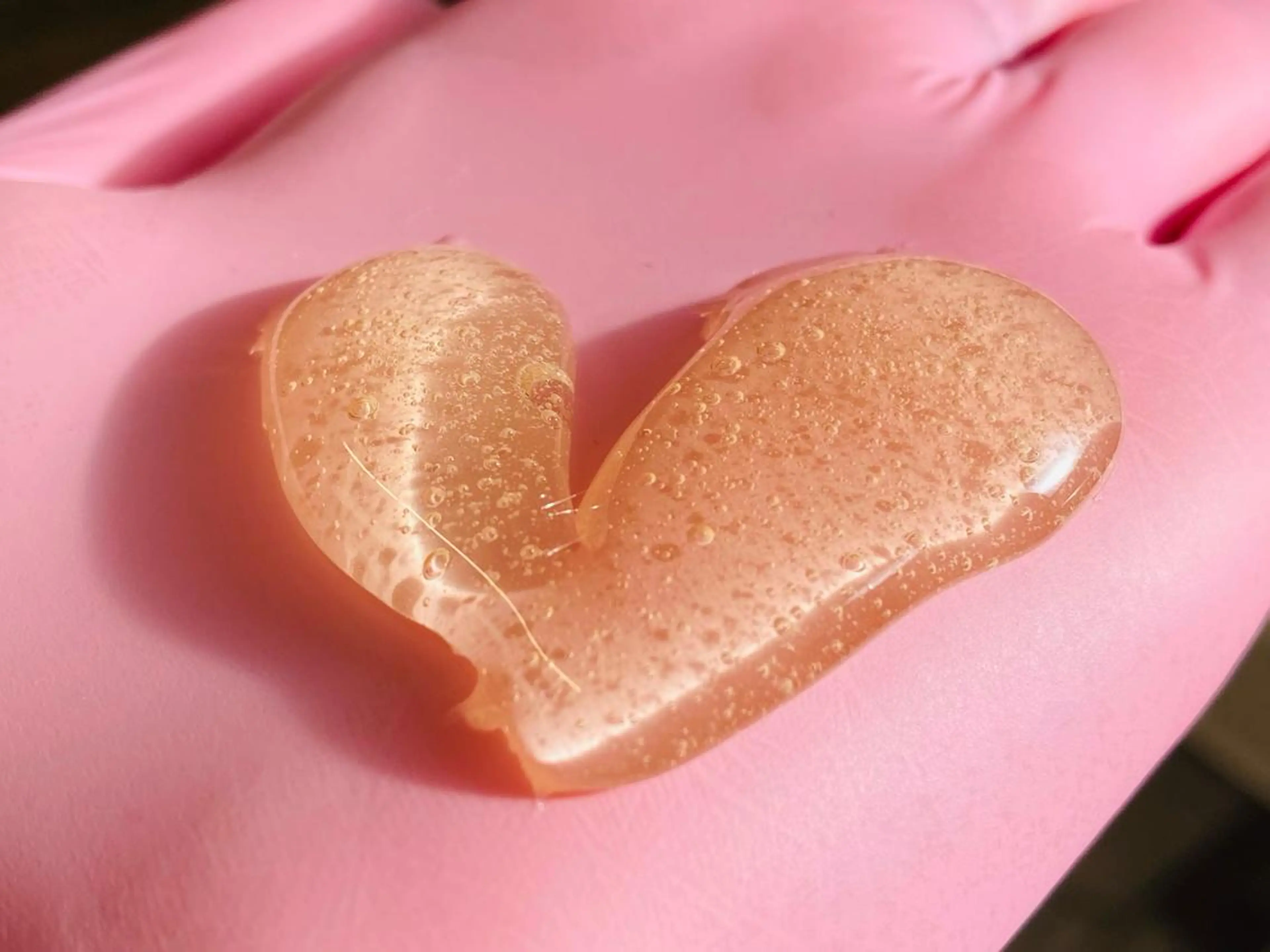 お腹全部まるっとケア♪シュガーリングで優しくケアしましょう。！おへそ周辺・へそ下に毛流れありませんか？卒シェービング♪の写真