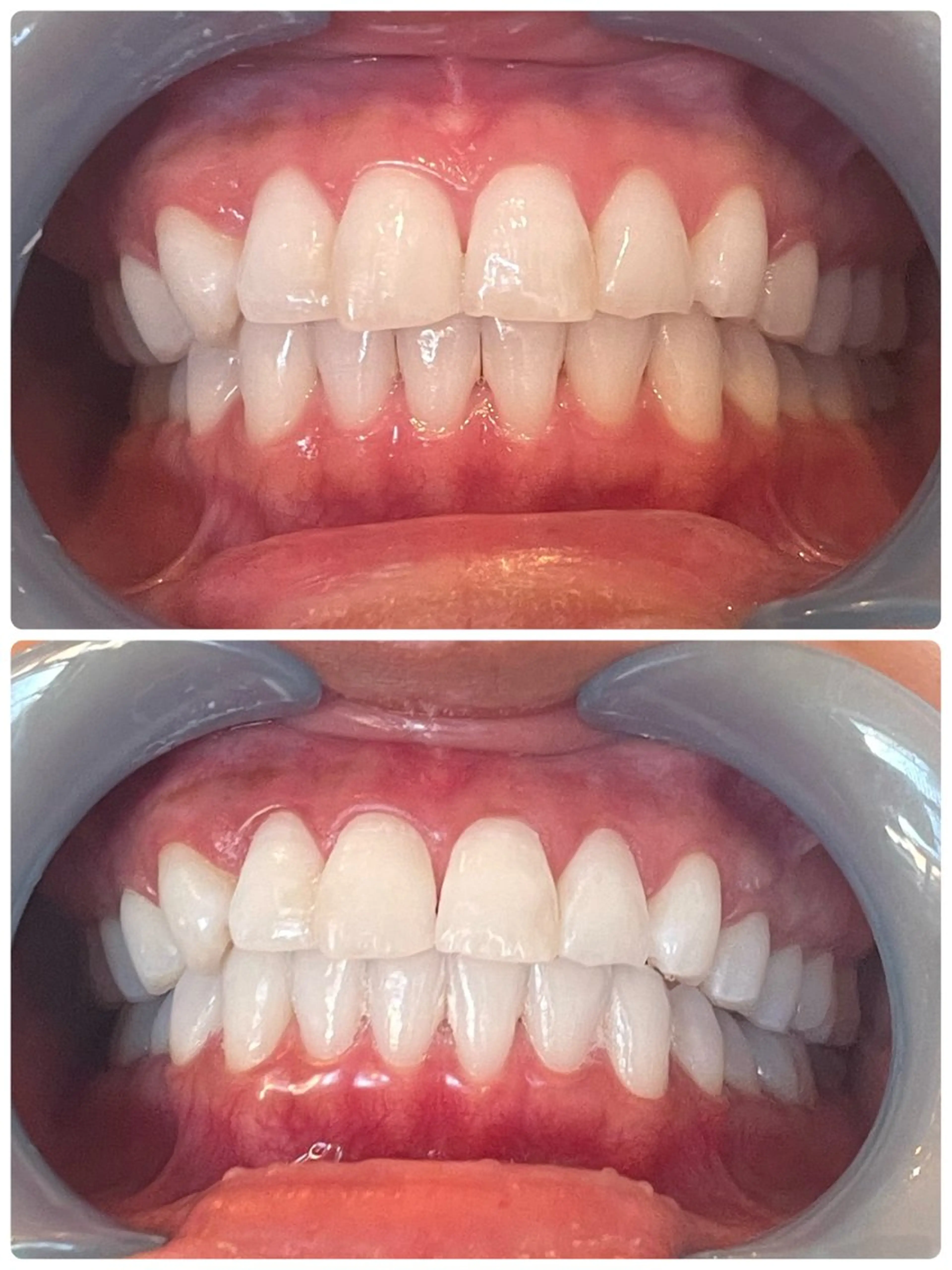 Monreve所属・美人スイッチdiet スーパージェクションのその他イメージ