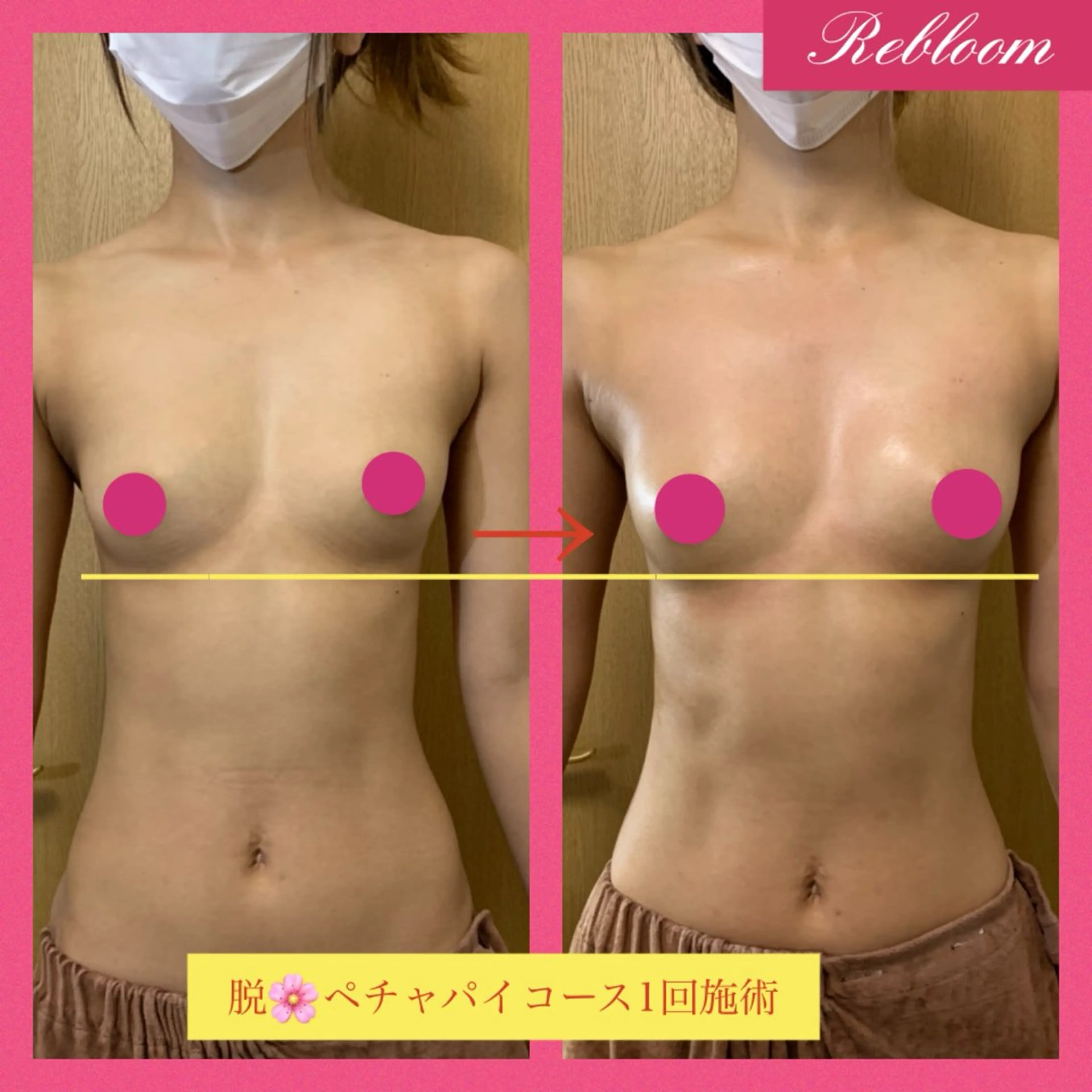 デリケートな悩み解決 Rebloomのエステ・リラクイメージ