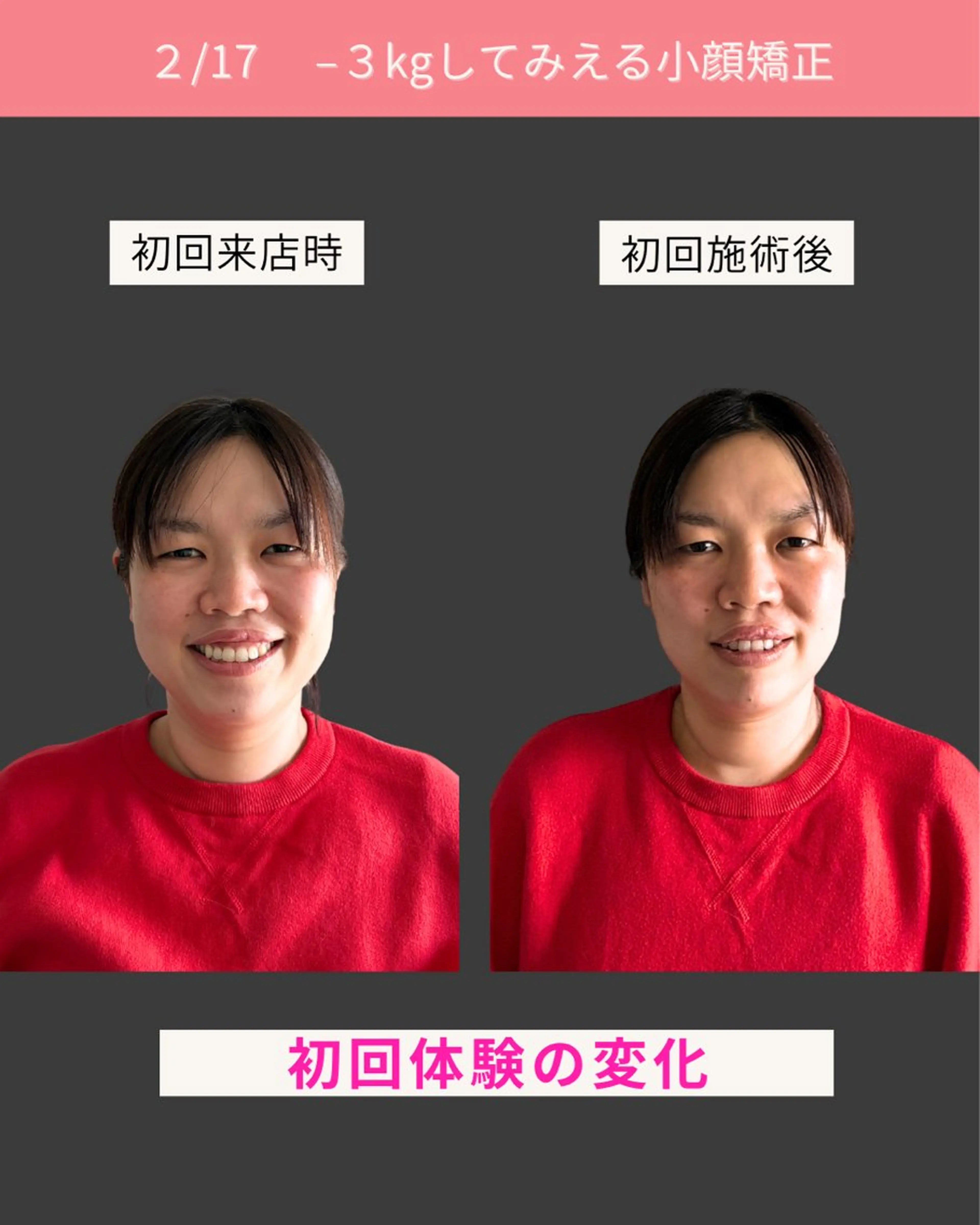 Noelie所属・美肌&小顔矯正 Noelieのエステ・リラクイメージ