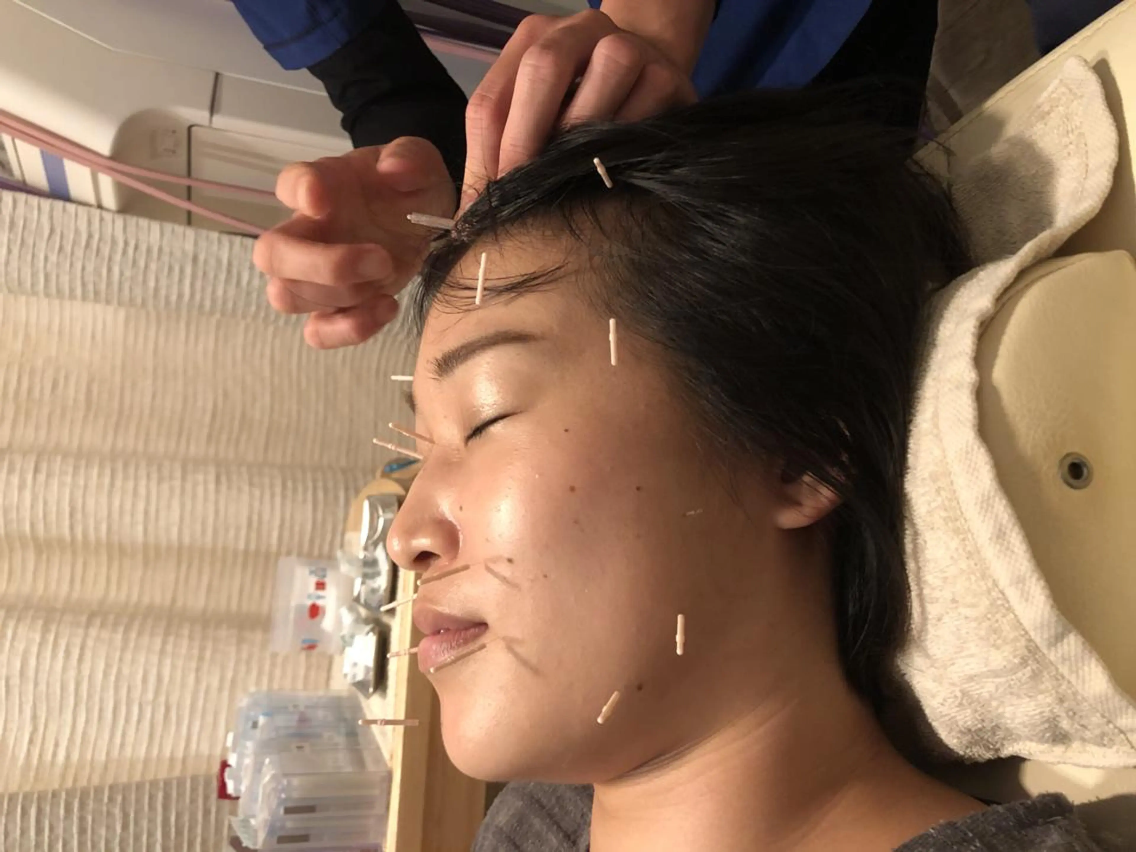 むくみたるみ専門☆ 美容鍼・小顔矯正のエステ・リラクイメージ