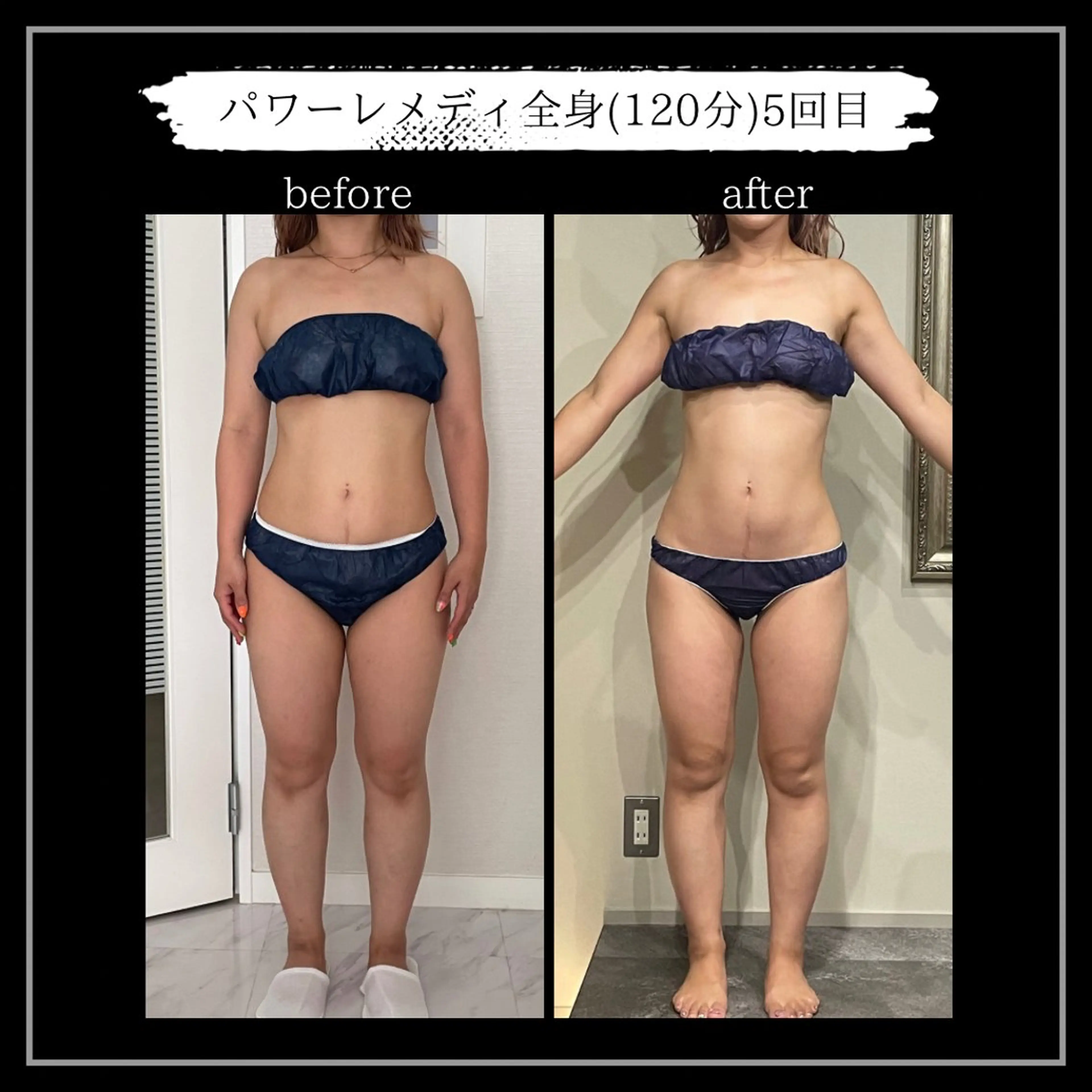 オフ:オン所属・オフ:オン 全身筋膜マッサージのエステ・リラクイメージ