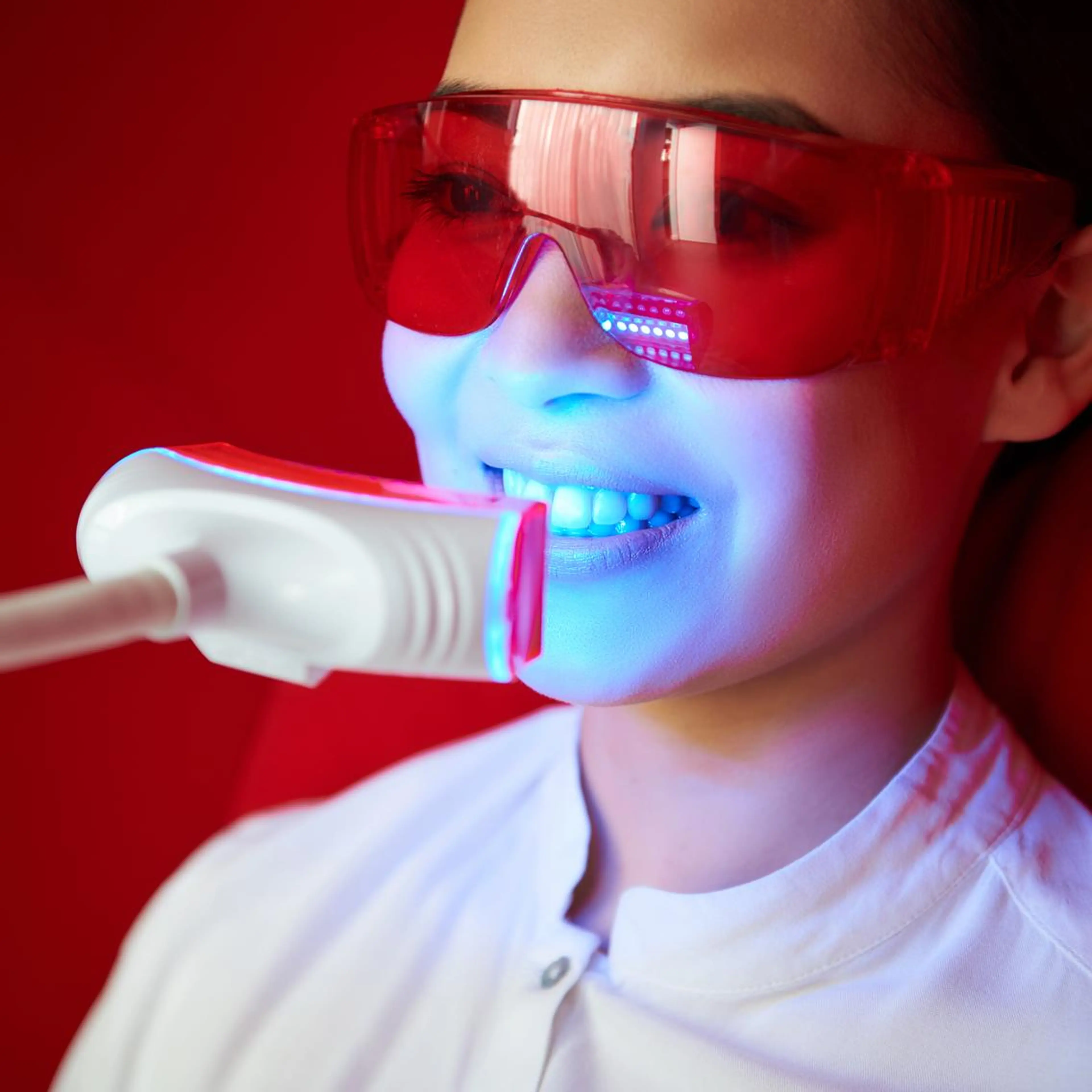 通常ホワイトニング（2照射）の写真