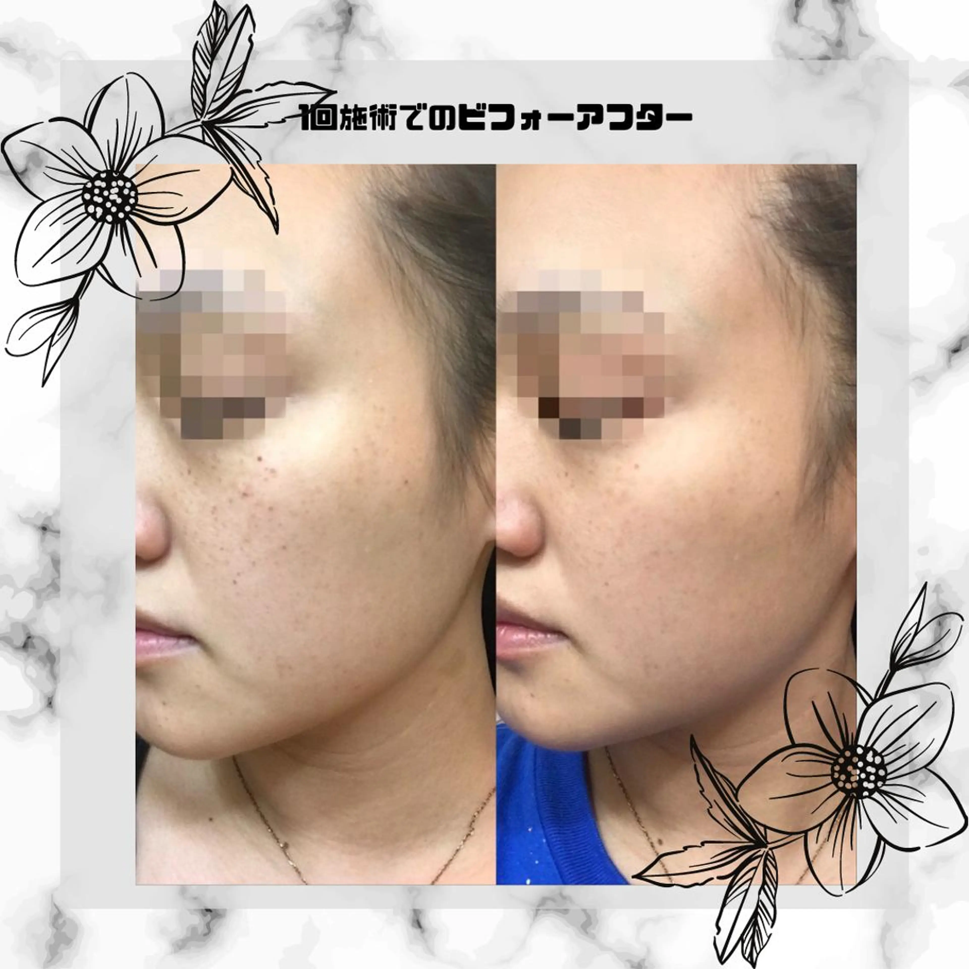 男女同額完全個室脱毛 LEPIA内田のエステ・リラクイメージ