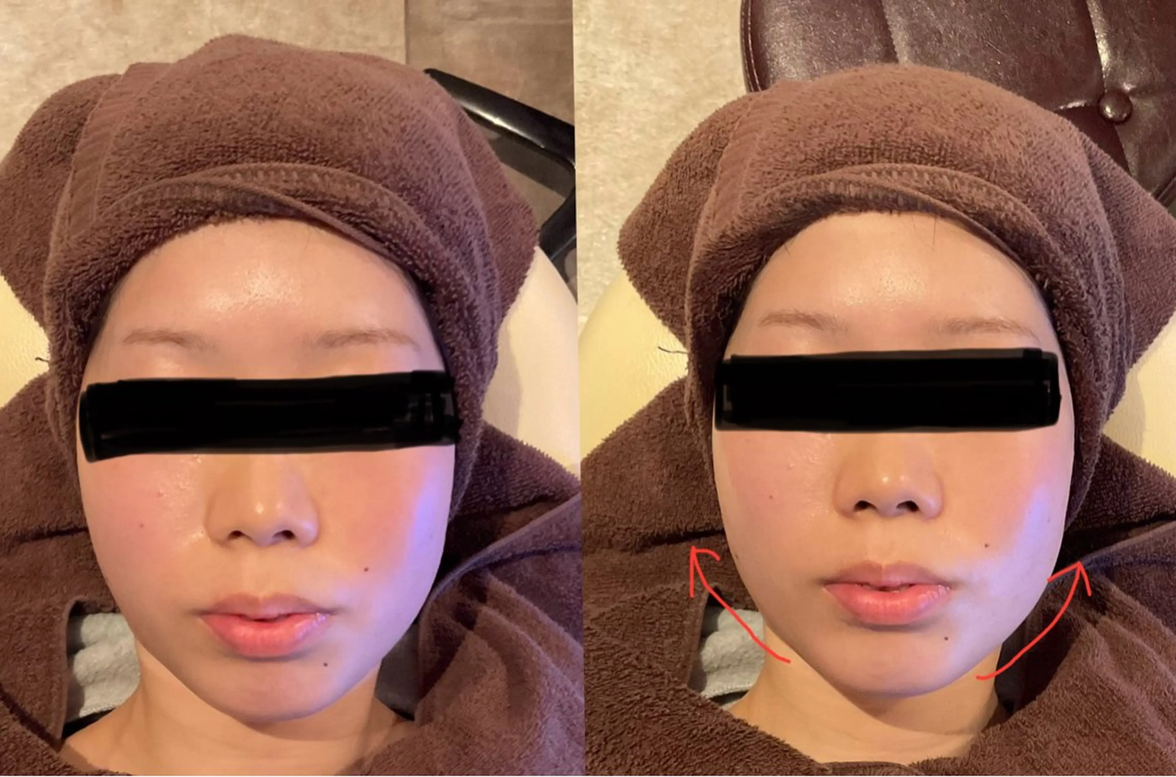 お顔スッキリ小顔メニュー✨人気のパック付きの写真