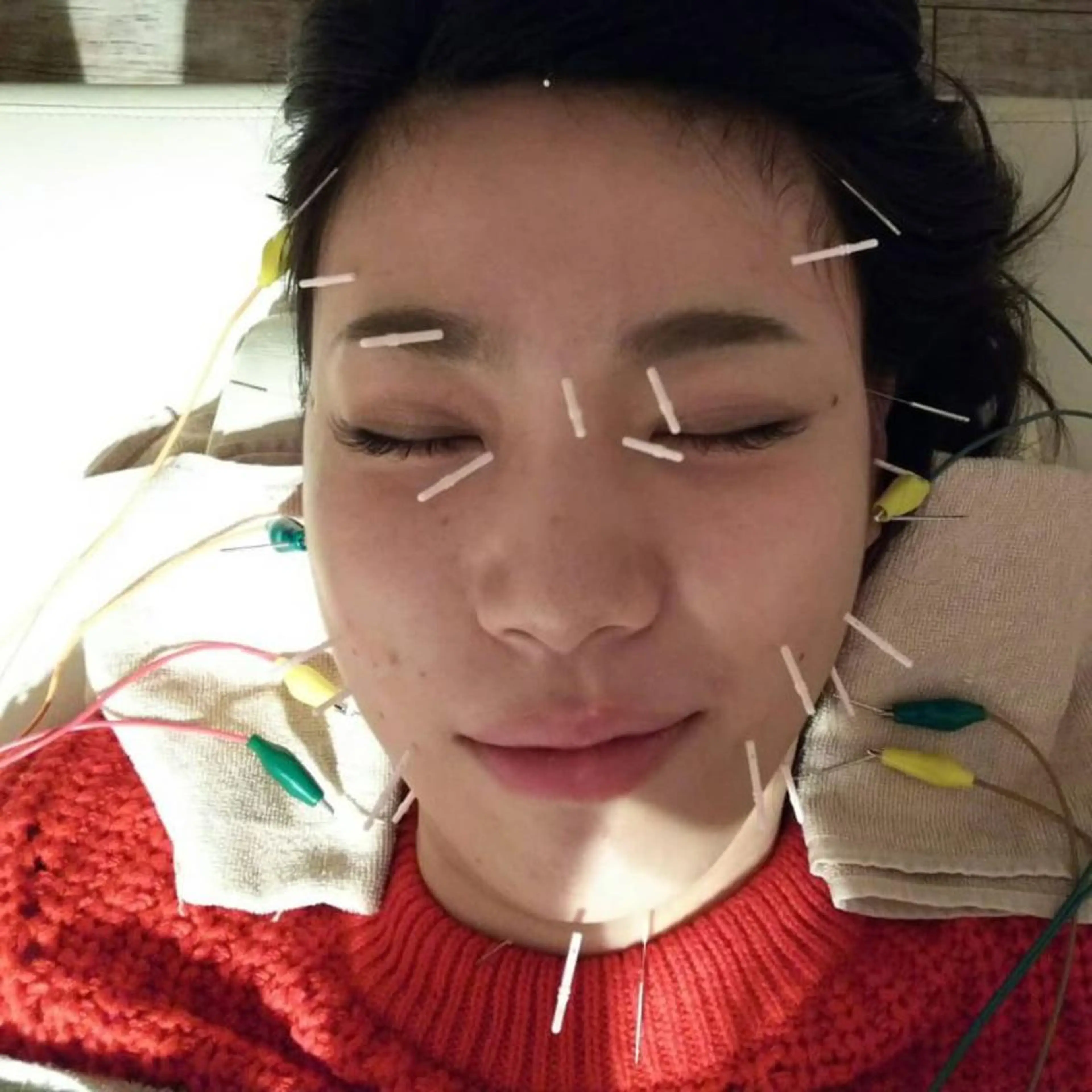 むくみたるみ専門☆ 美容鍼・小顔矯正のエステ・リラクイメージ