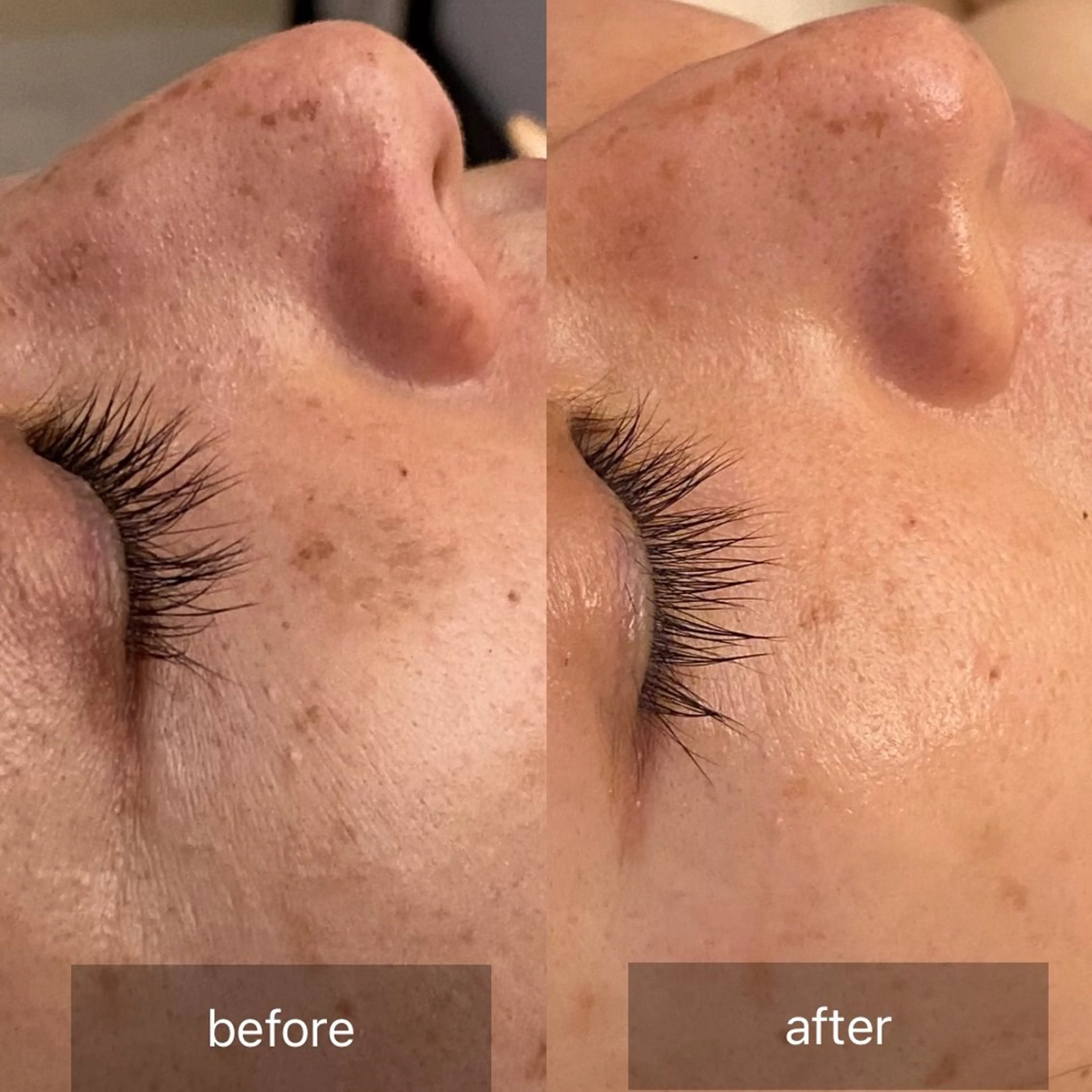 hm NATURESKINのエステ・リラクイメージ