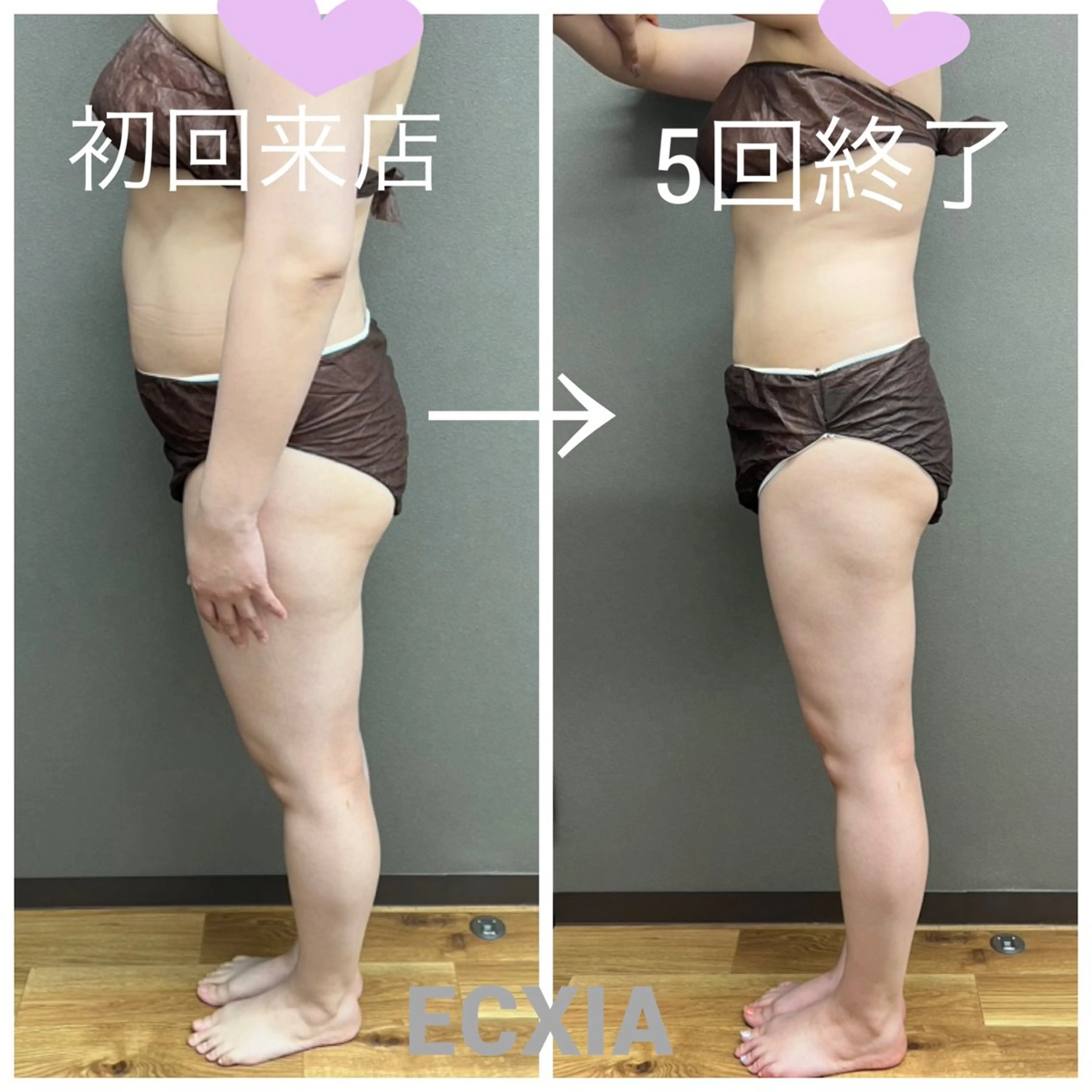 エステ リラク ECXIA 【エクシア】のエステ・リラクイメージ