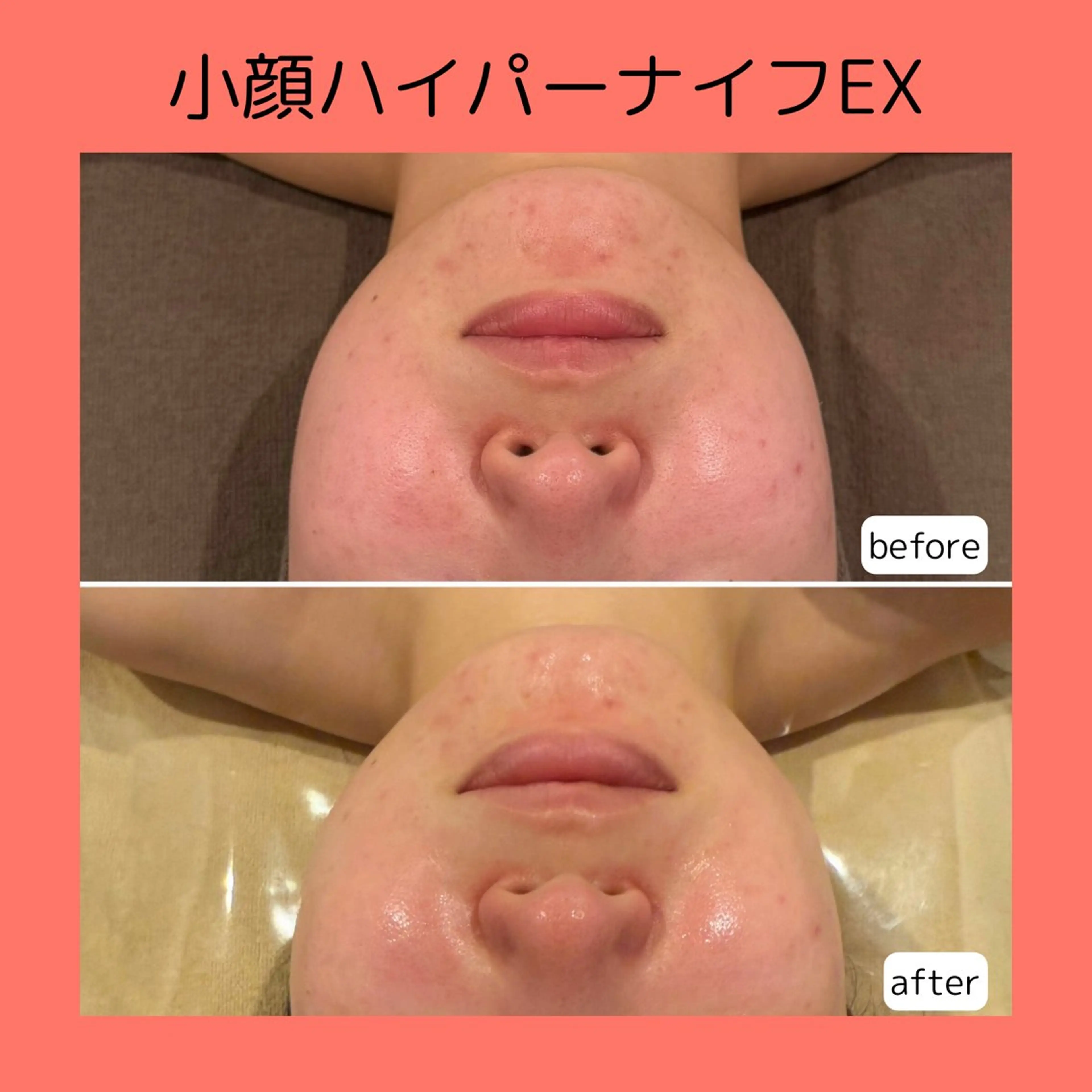 赤澤/本気痩せ・脱毛 ・ノーファンデ肌のその他イメージ