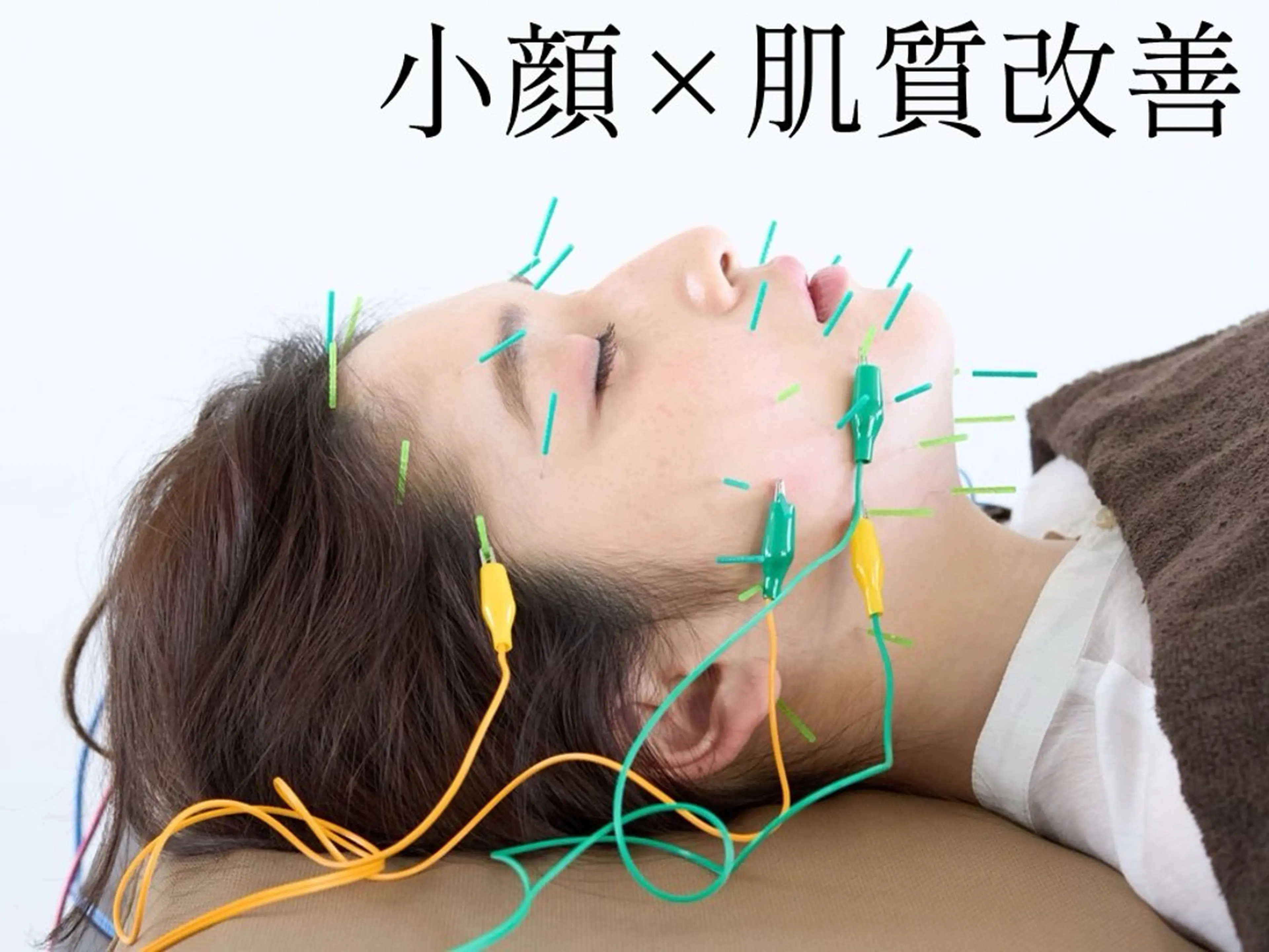 3/10用メニューリクエスト⭐️ララピール体験＋ニキビケアコース150分！　※撮影モデル募集ニキビケア/たるみケアの写真