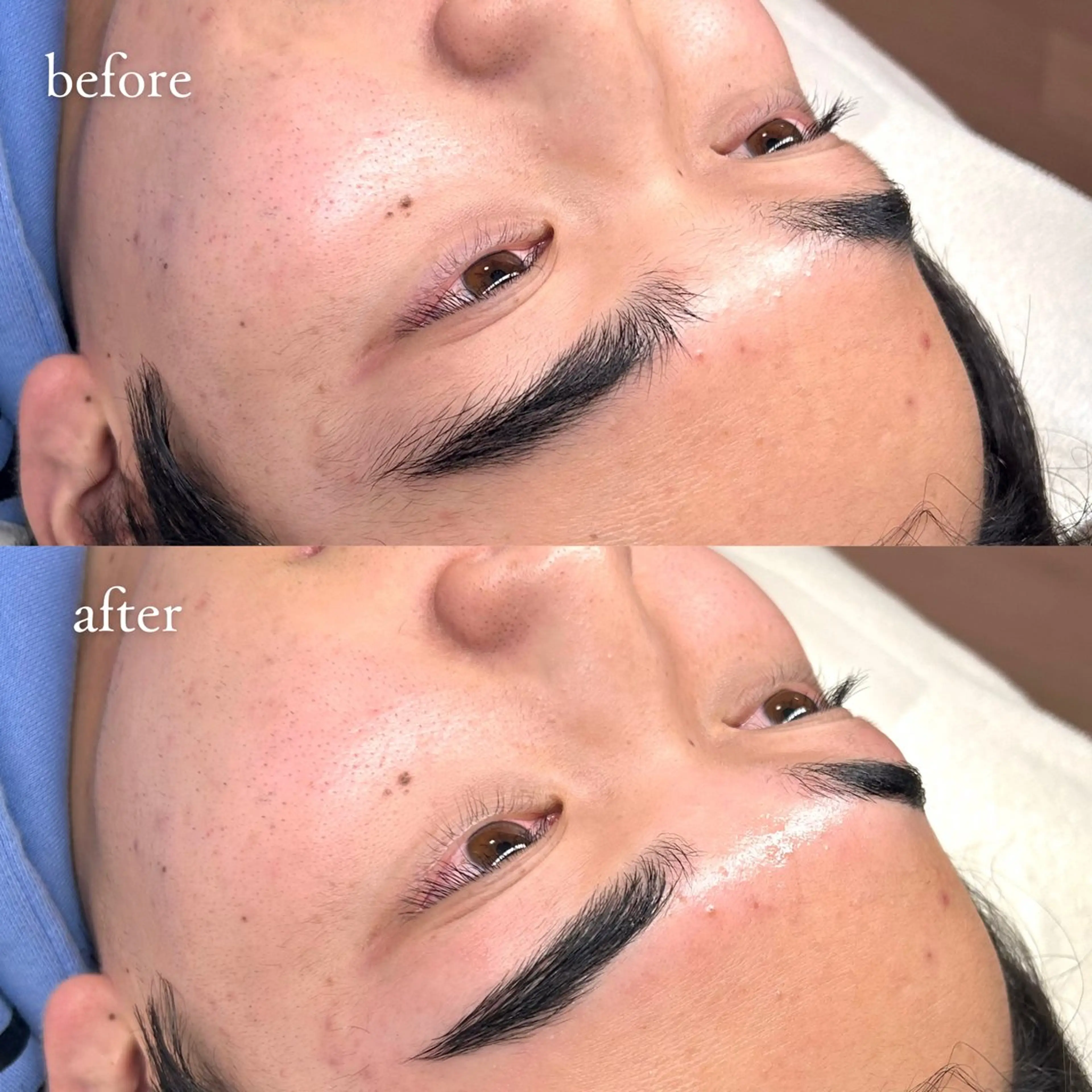 メンズ アイブロウ メンズアイブロウ アイブロウサロンTreat myself所属・Treat myselfの眉毛・アイブロウイメージ