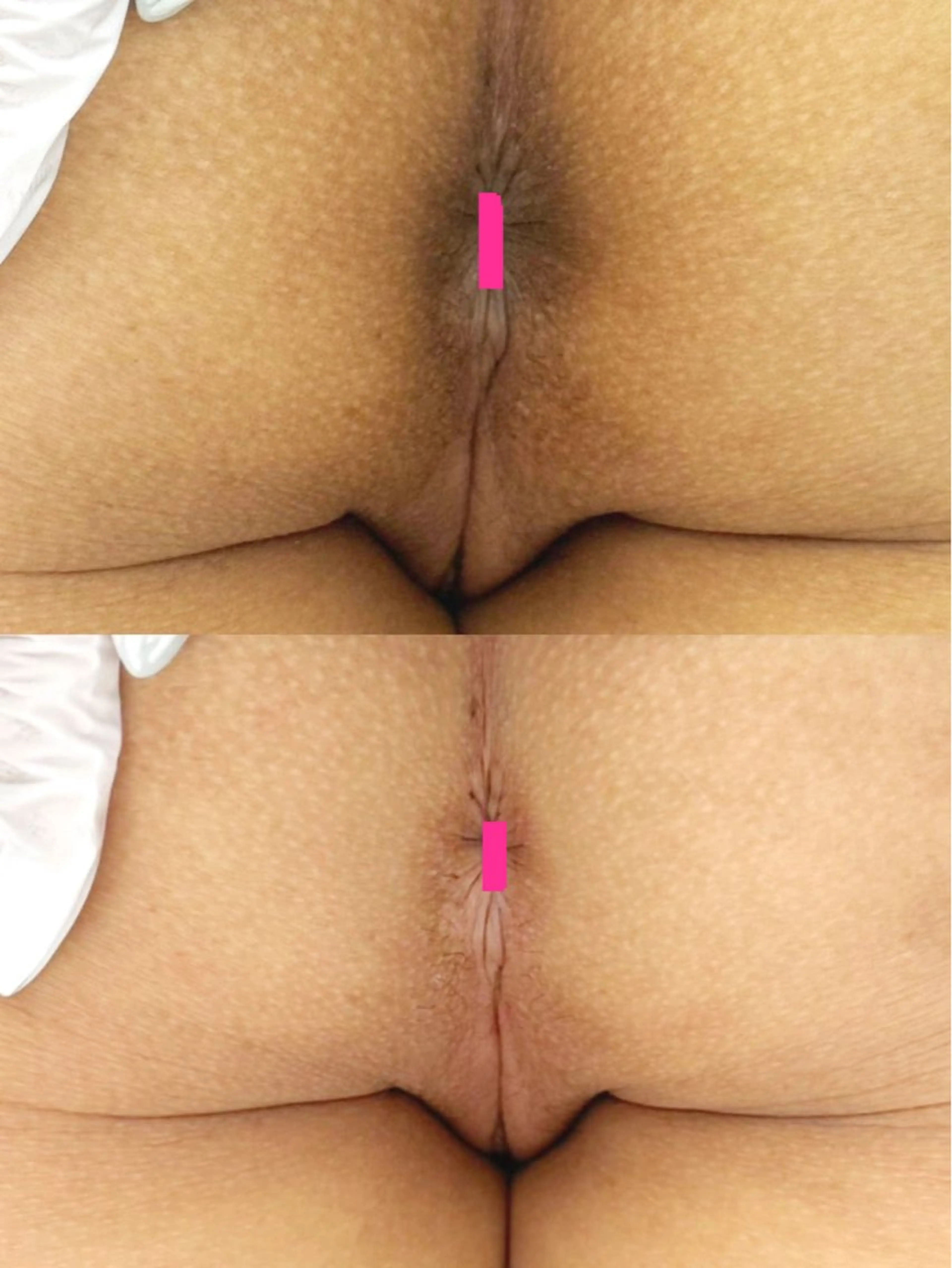 小顔専門看護師クリニカルサロンCOCO所属・小顔と美肌サロン クリニカルサロンココのエステ・リラクイメージ