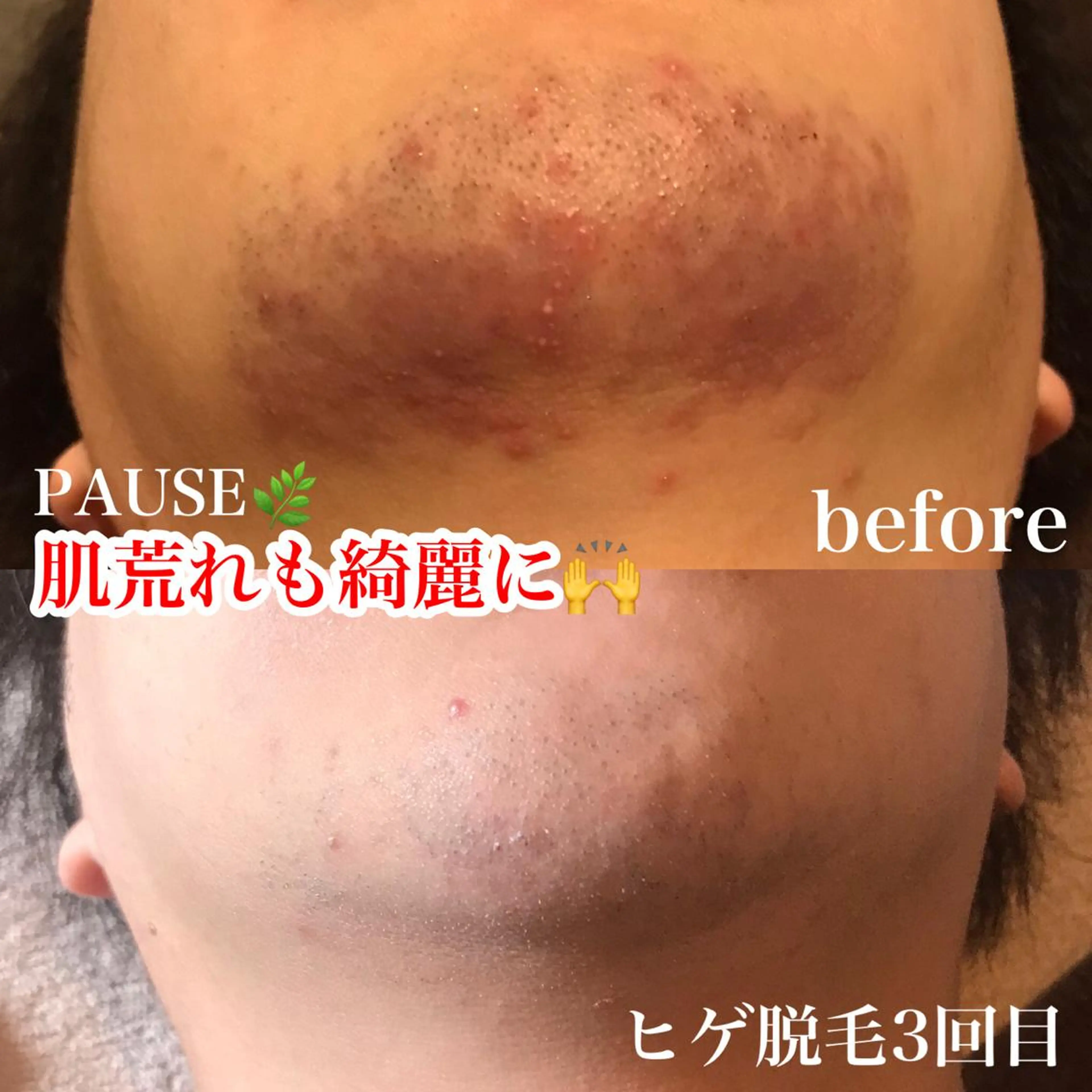 脱毛 浜野 恵美のエステ・リラクイメージ