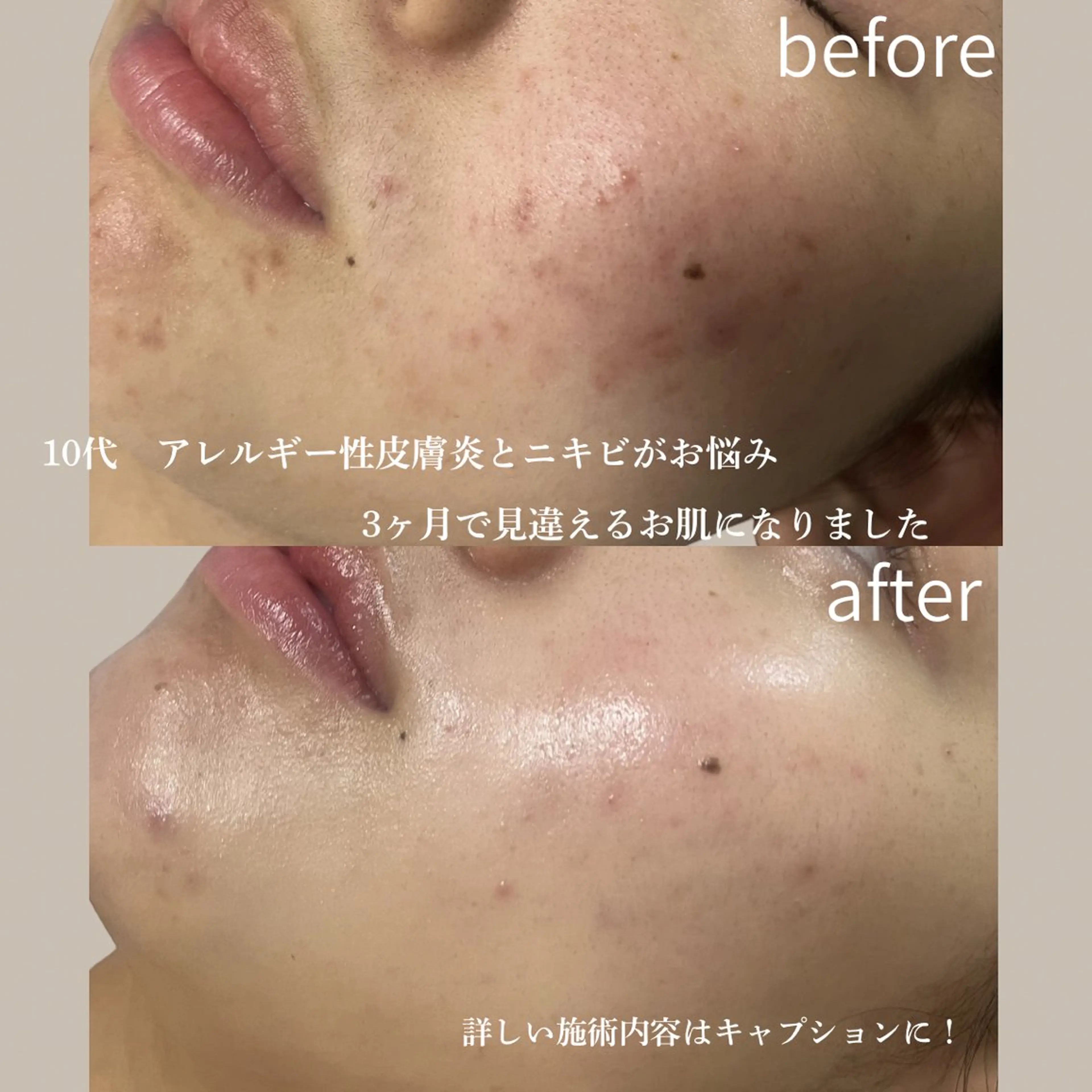 エステ リラク Total Beauty salon Bloom所属・肌質改善/ 脱毛/Bloomのエステ・リラクイメージ