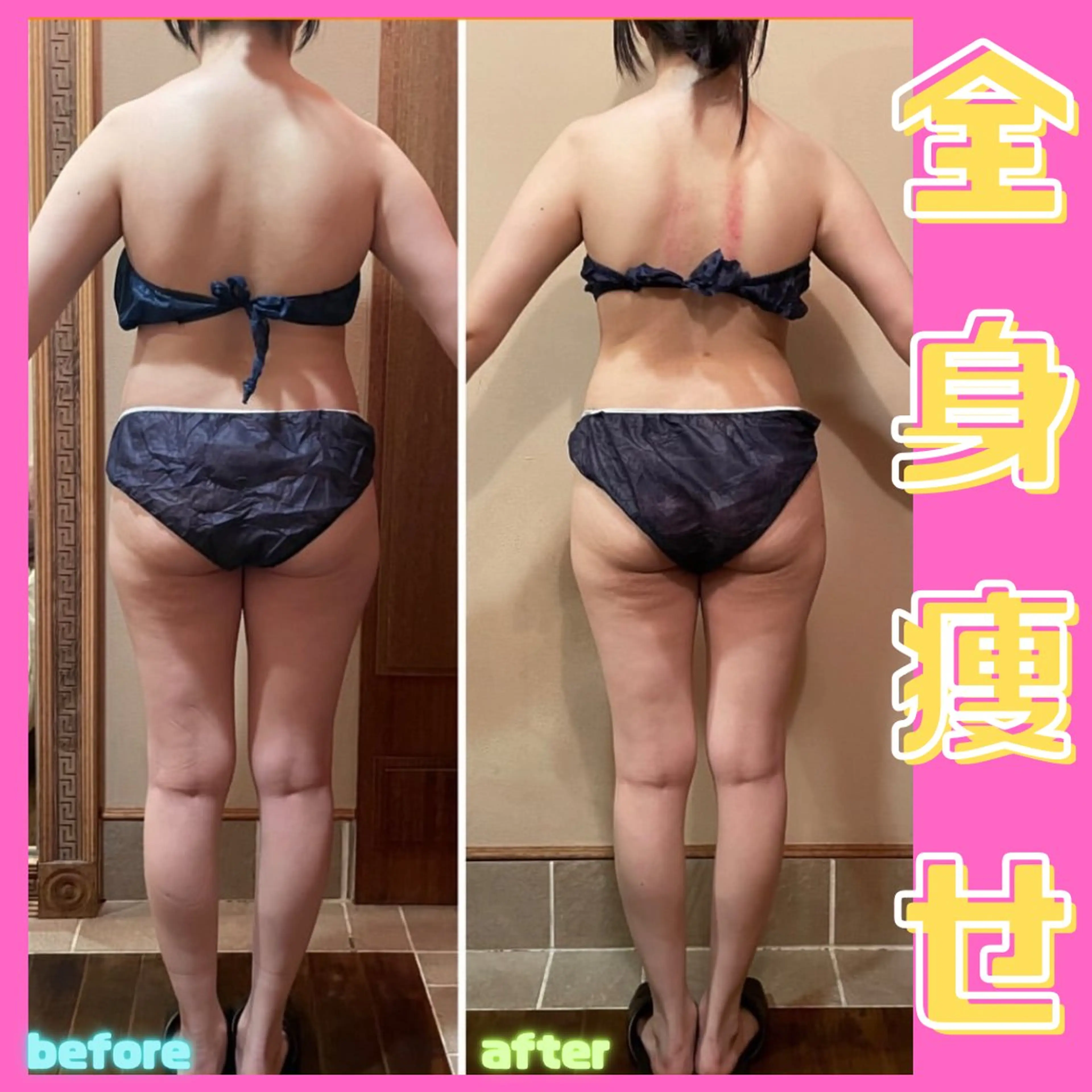 エステ リラク 痩身&美肌サロン 堀米✨のその他イメージ