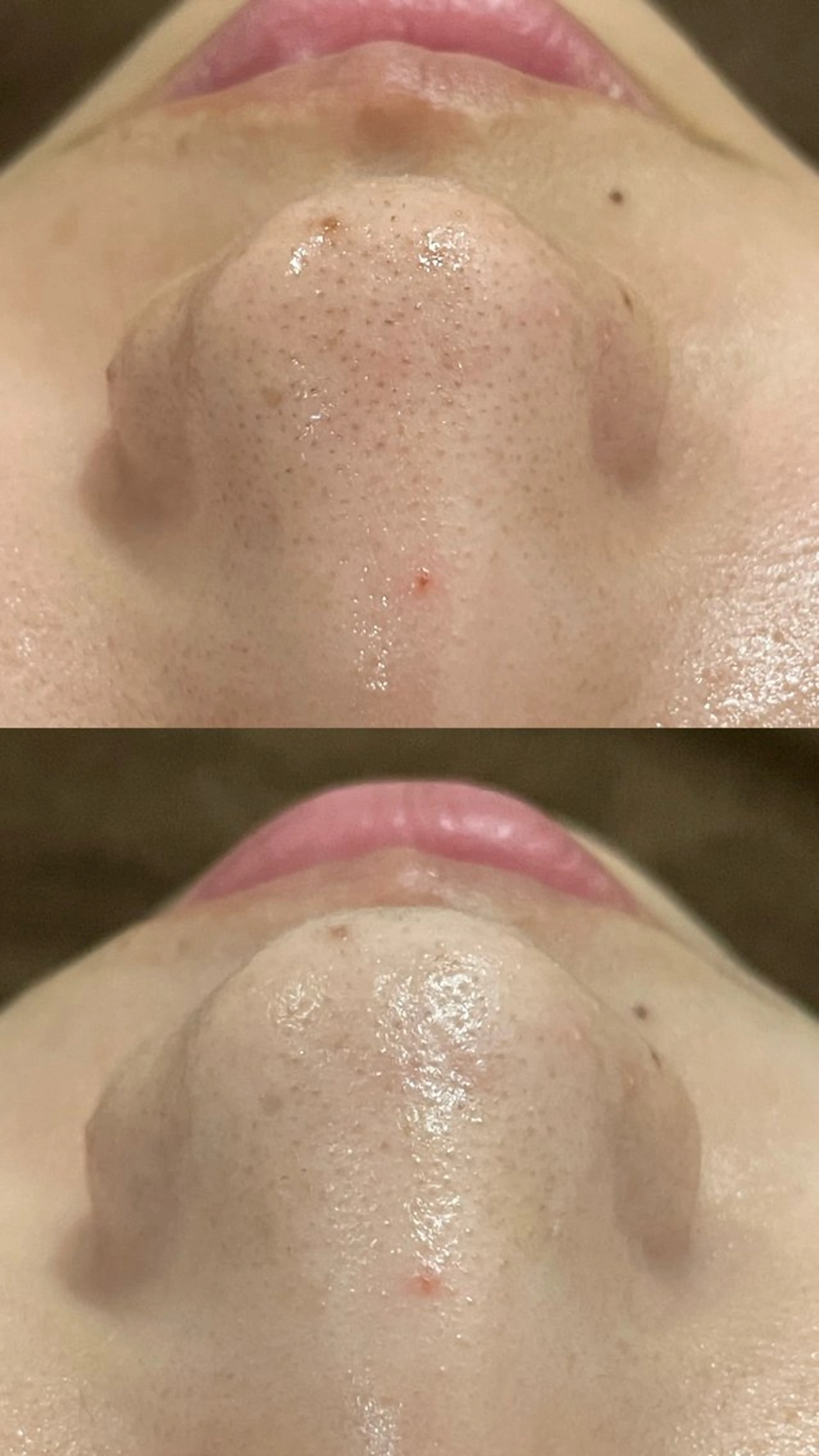 Folche三川町ア ピールポイント確認！のエステ・リラクイメージ