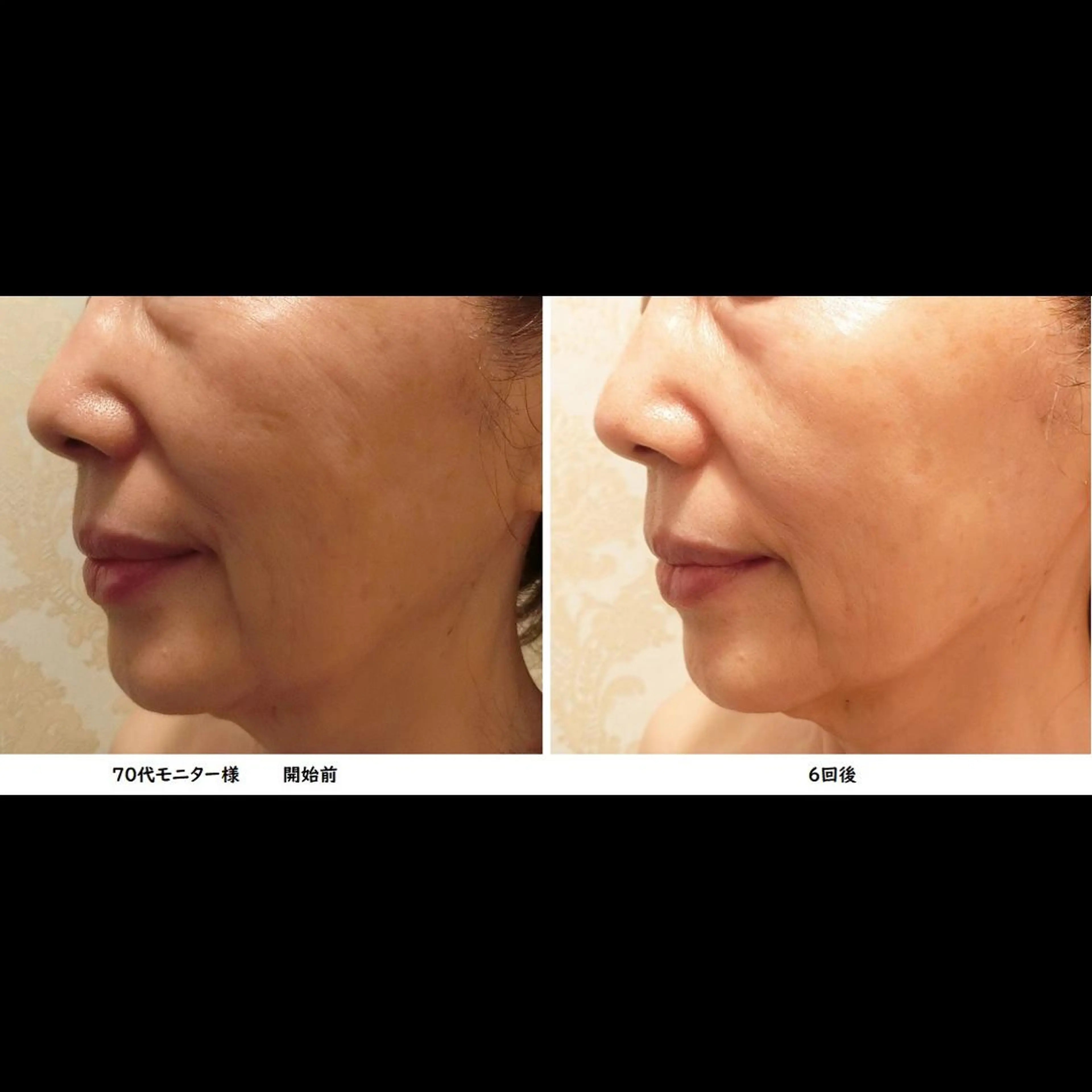 くびれ作り専門サロン こねこのシッポ虎ノ門のエステ・リラクイメージ