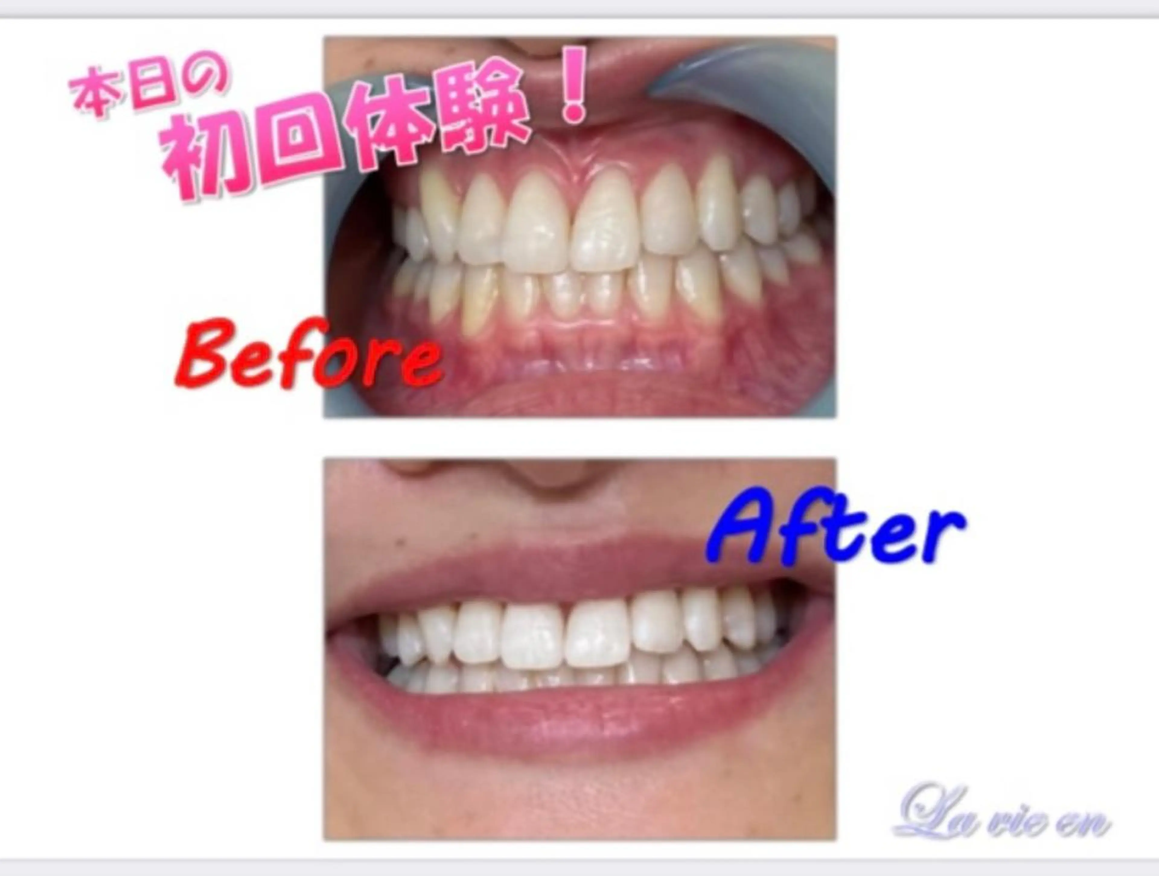 その他 セルフホワイトニングサロン　ラヴィアン所属・ホワイトニングサロン La vie enのその他イメージ