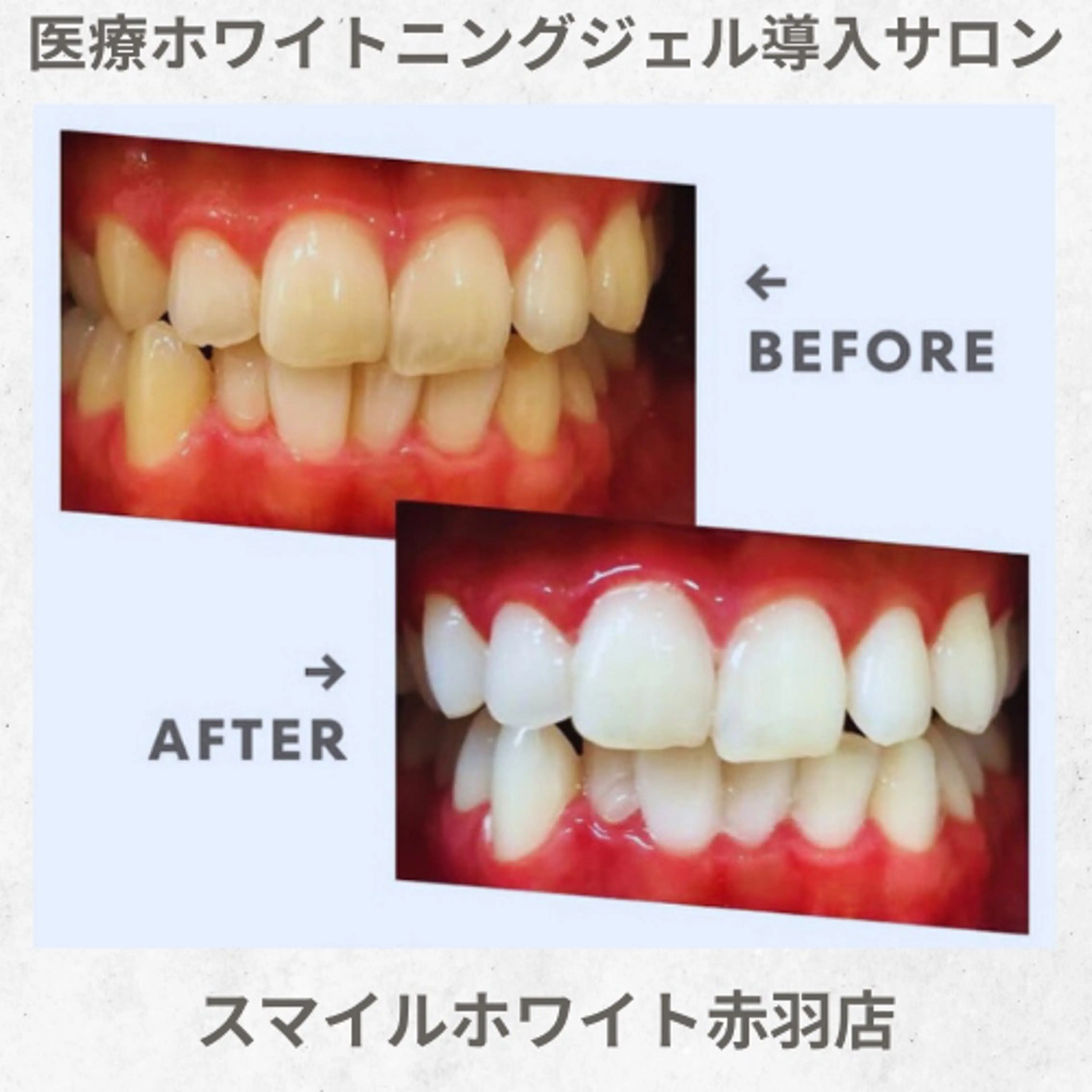 パーマ スマイルホワイト 赤羽店のエステ・リラクイメージ