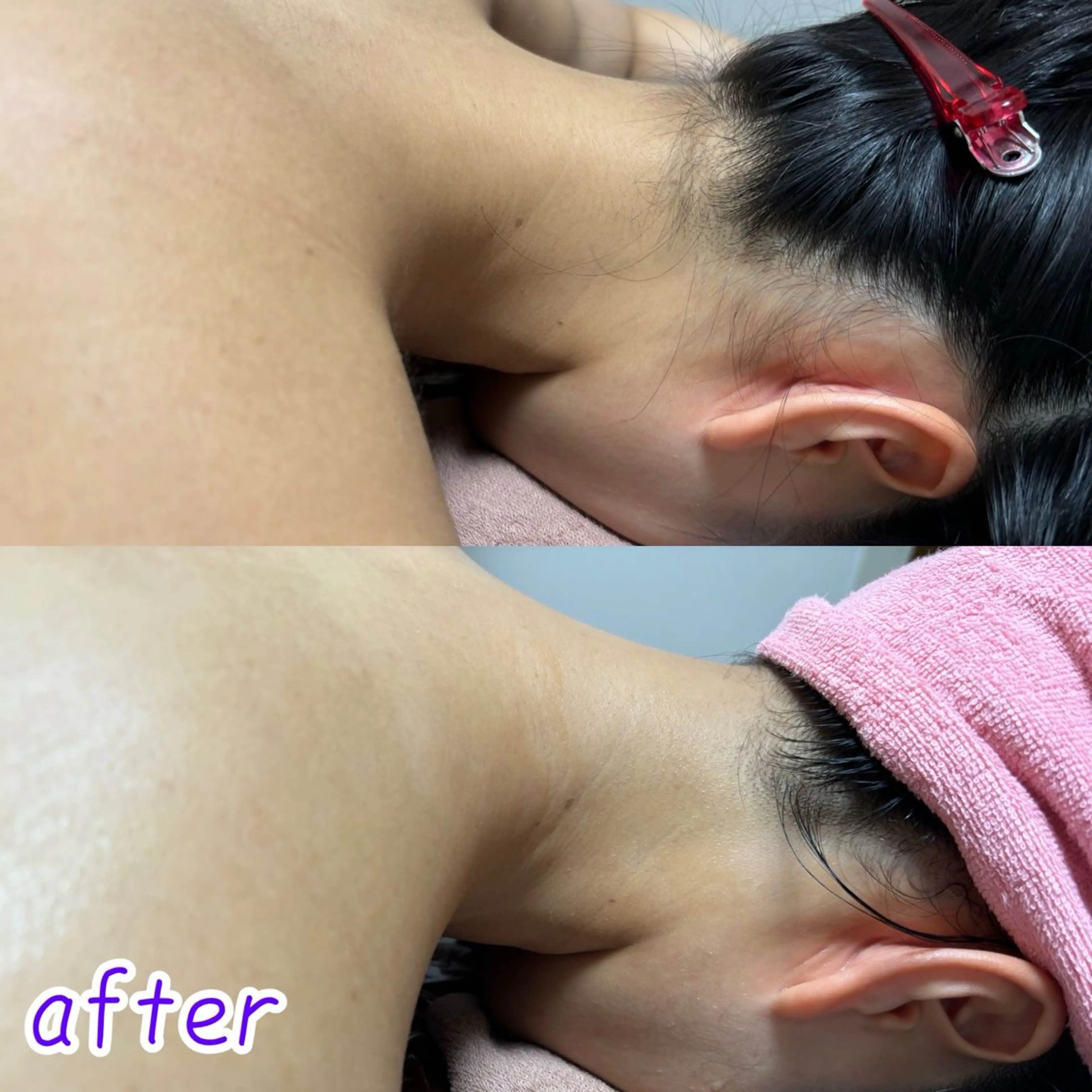 透明感の肌Lino malieのエステ・リラクイメージ